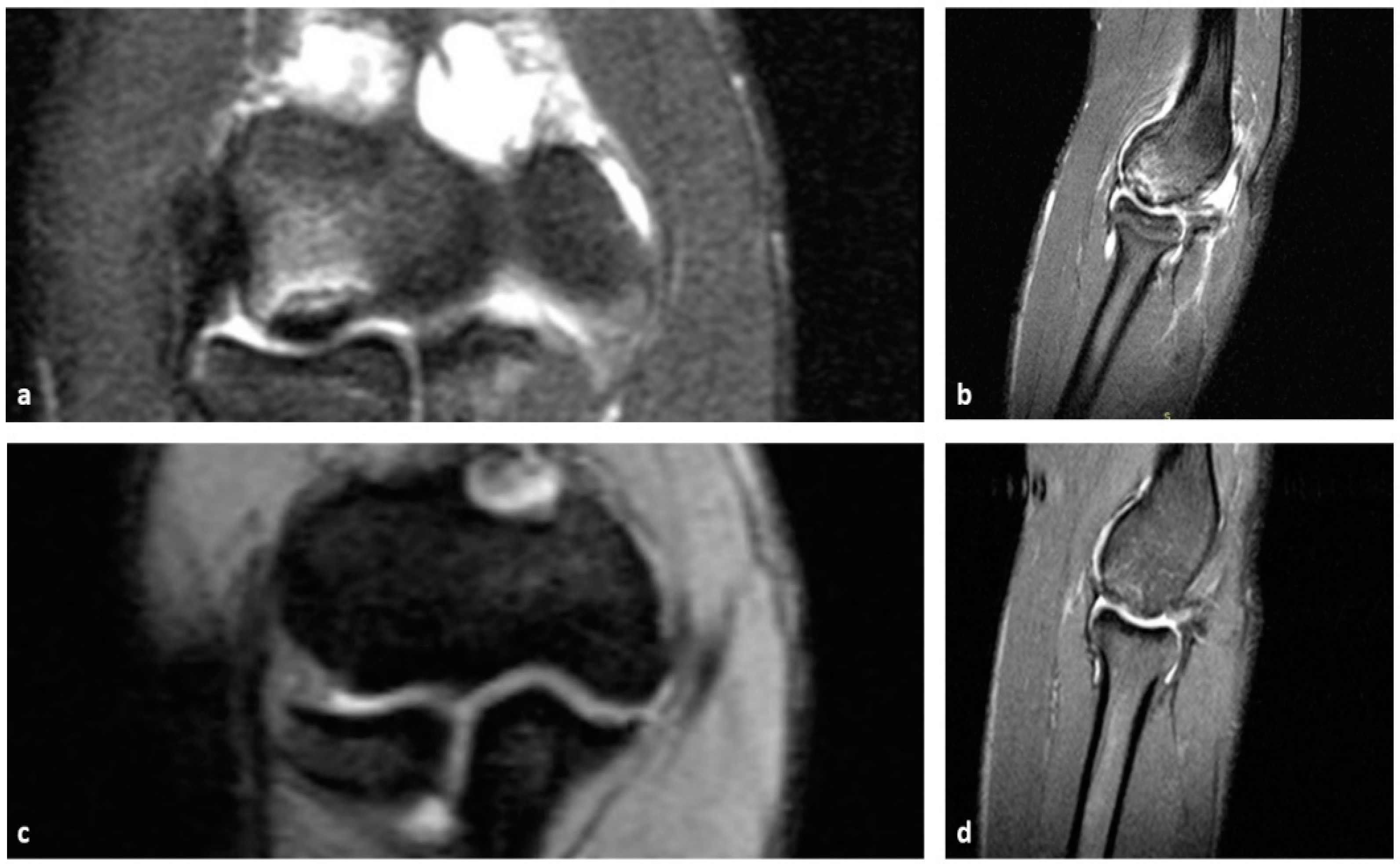 Diagnostics 14 00916 g003 Diagnostics 14 00916 g003