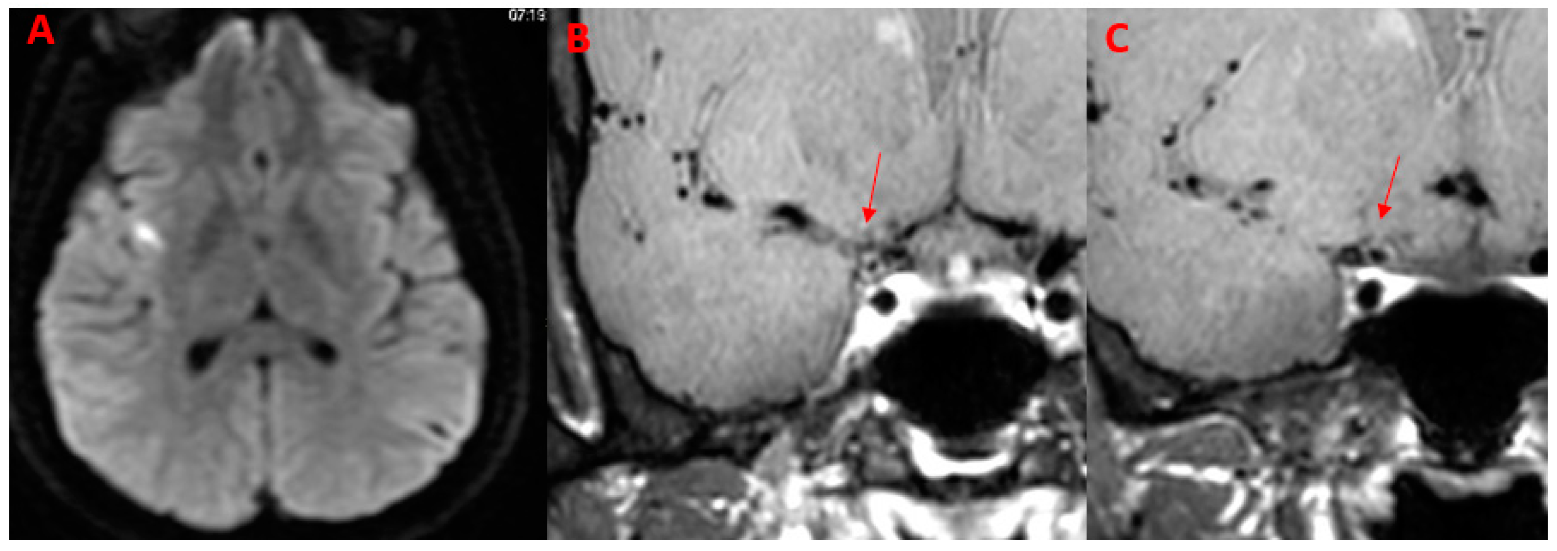 Diagnostics 14 00927 g002