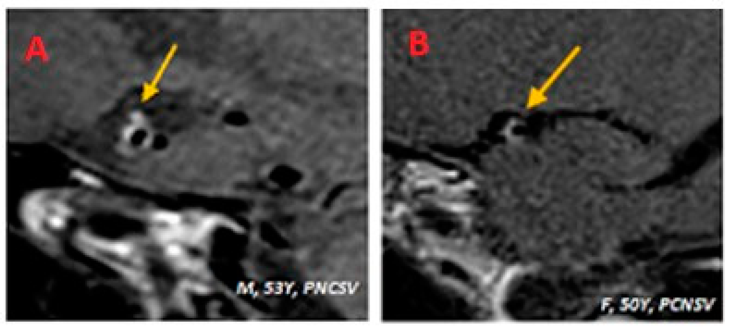 Diagnostics 14 00927 g003