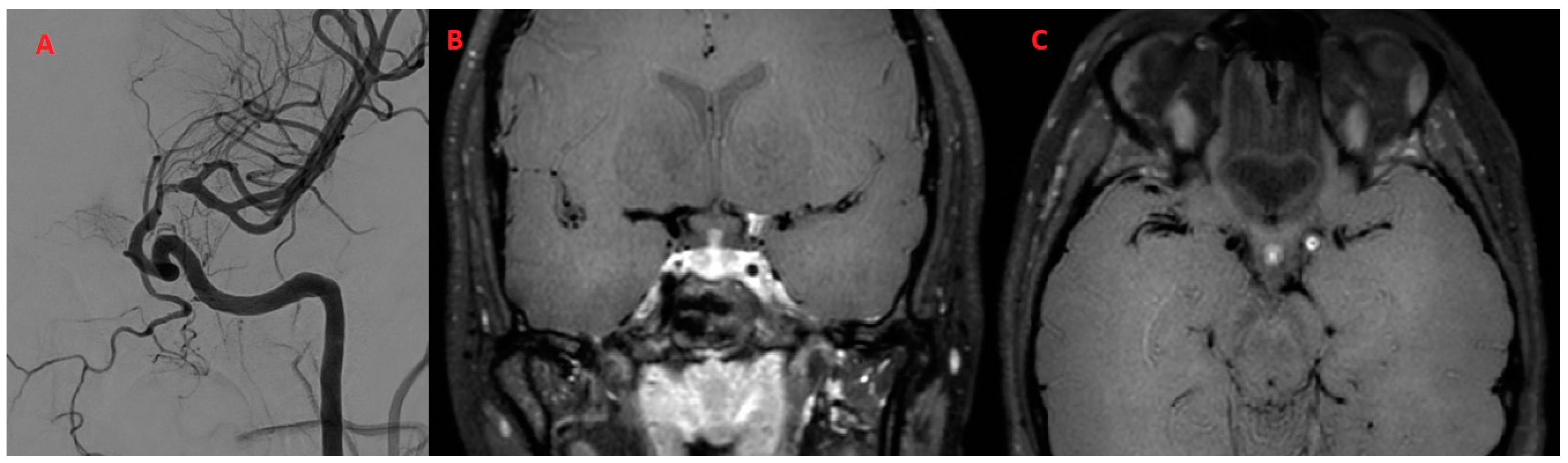 Diagnostics 14 00927 g004