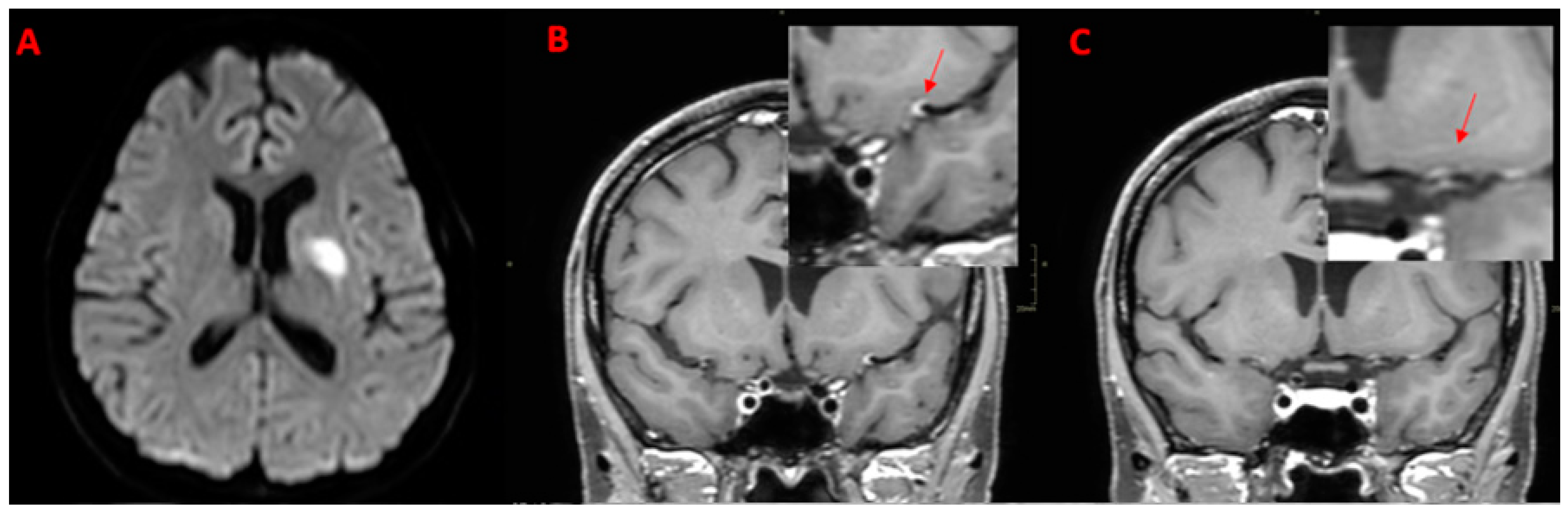 Diagnostics 14 00927 g006