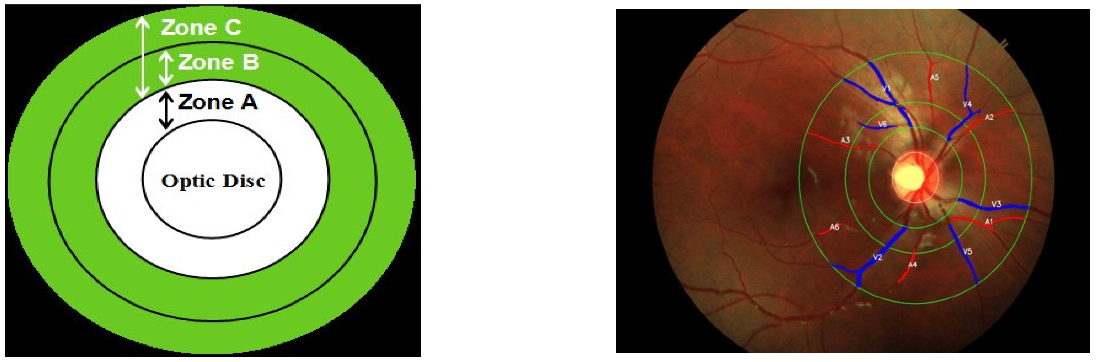 Diagnostics 14 00928 g002