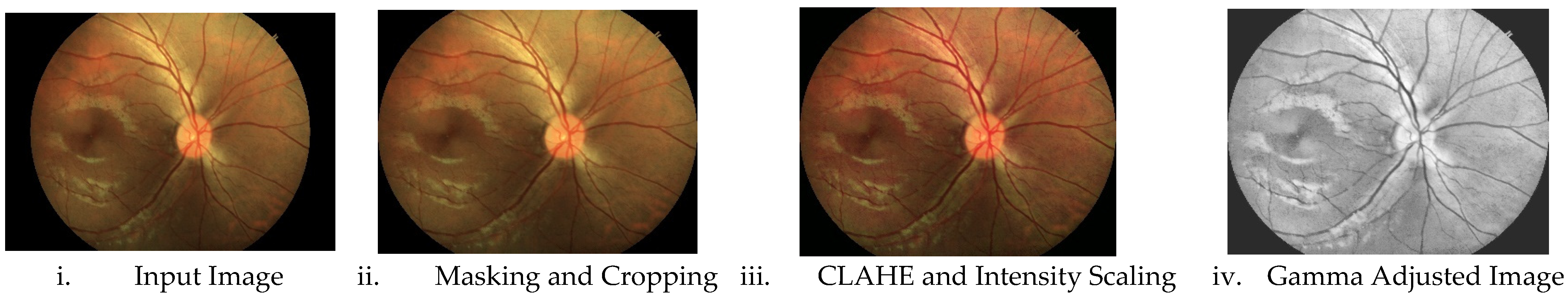 Diagnostics 14 00928 g003