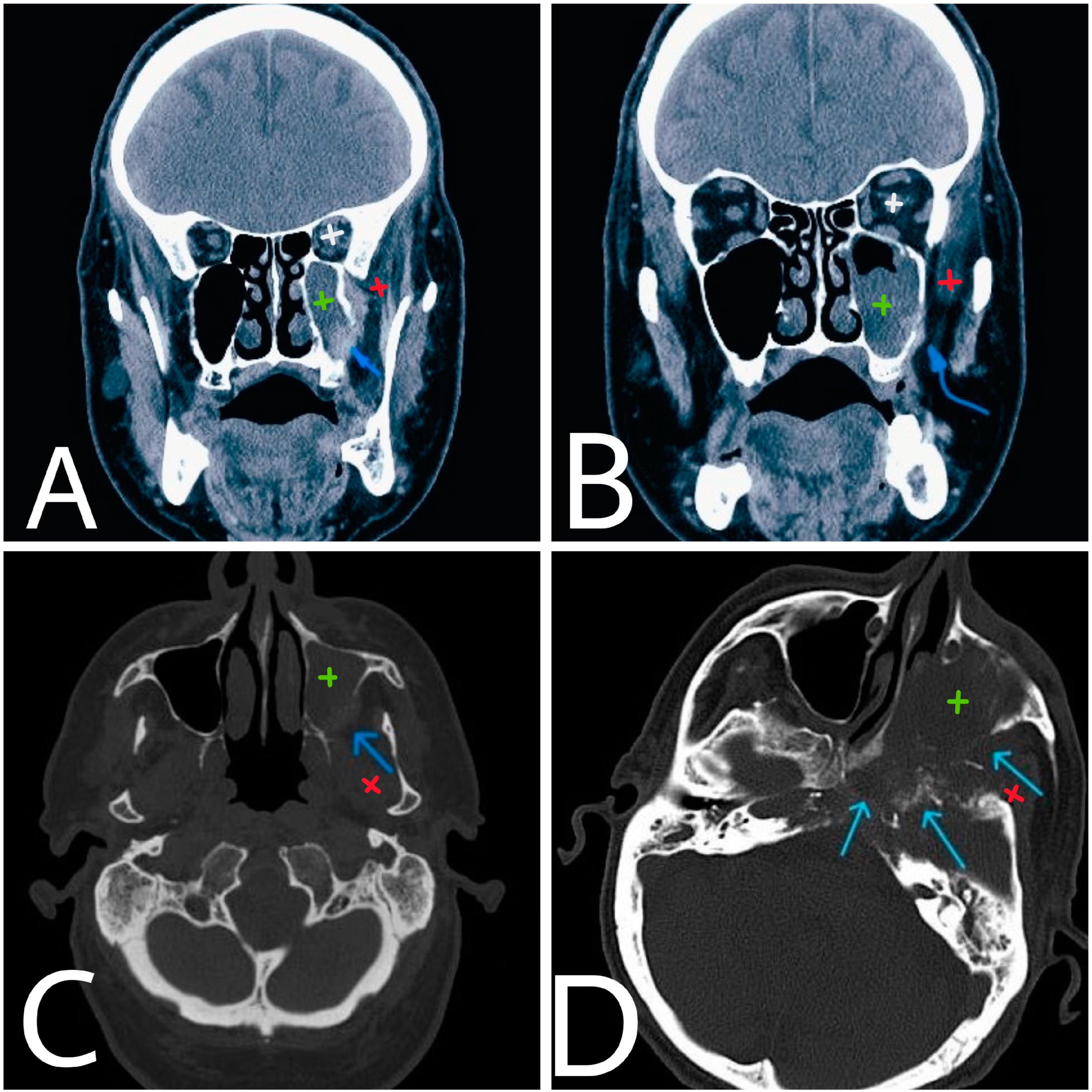 Diagnostics 14 00932 g001