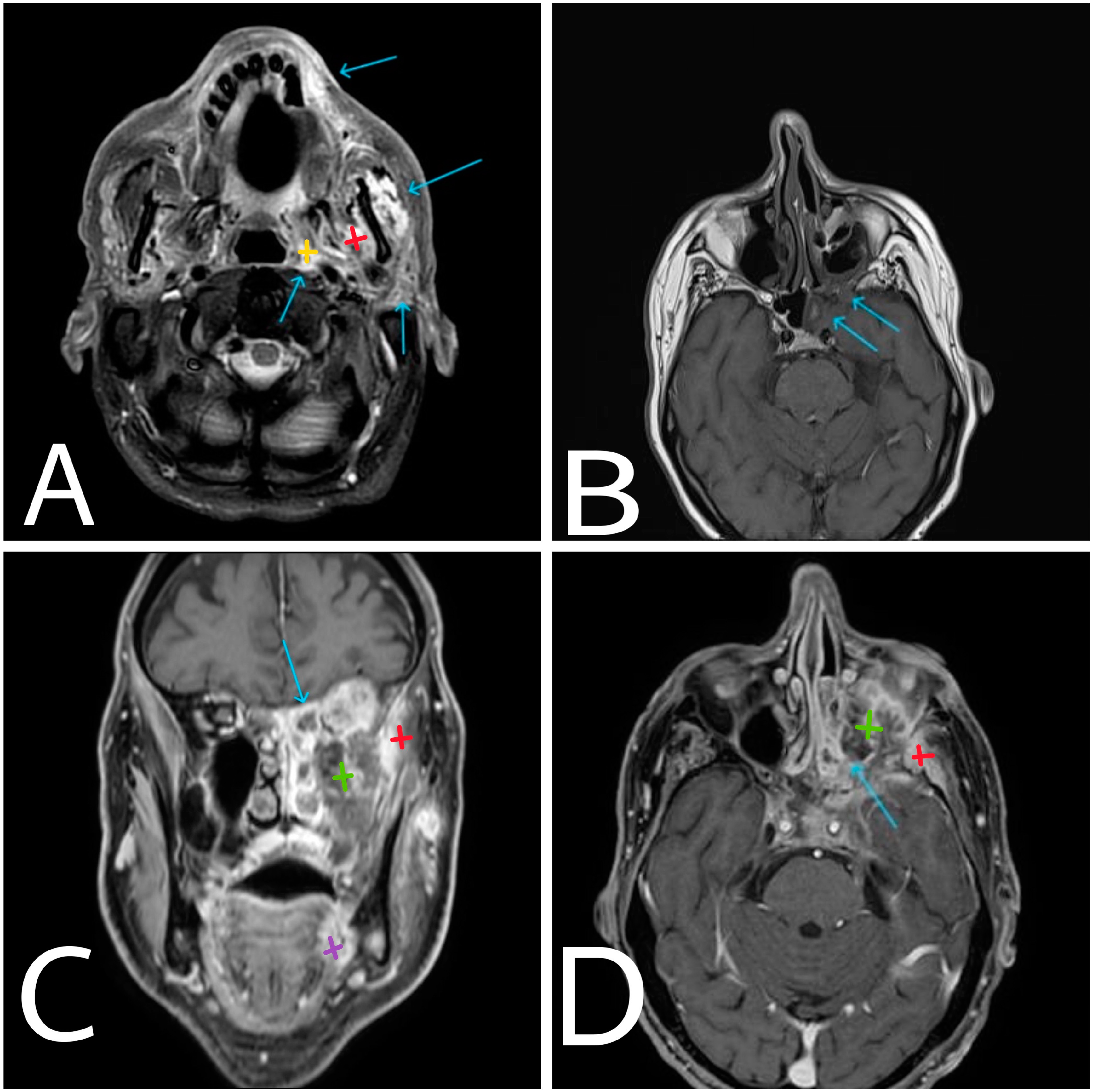 Diagnostics 14 00932 g002