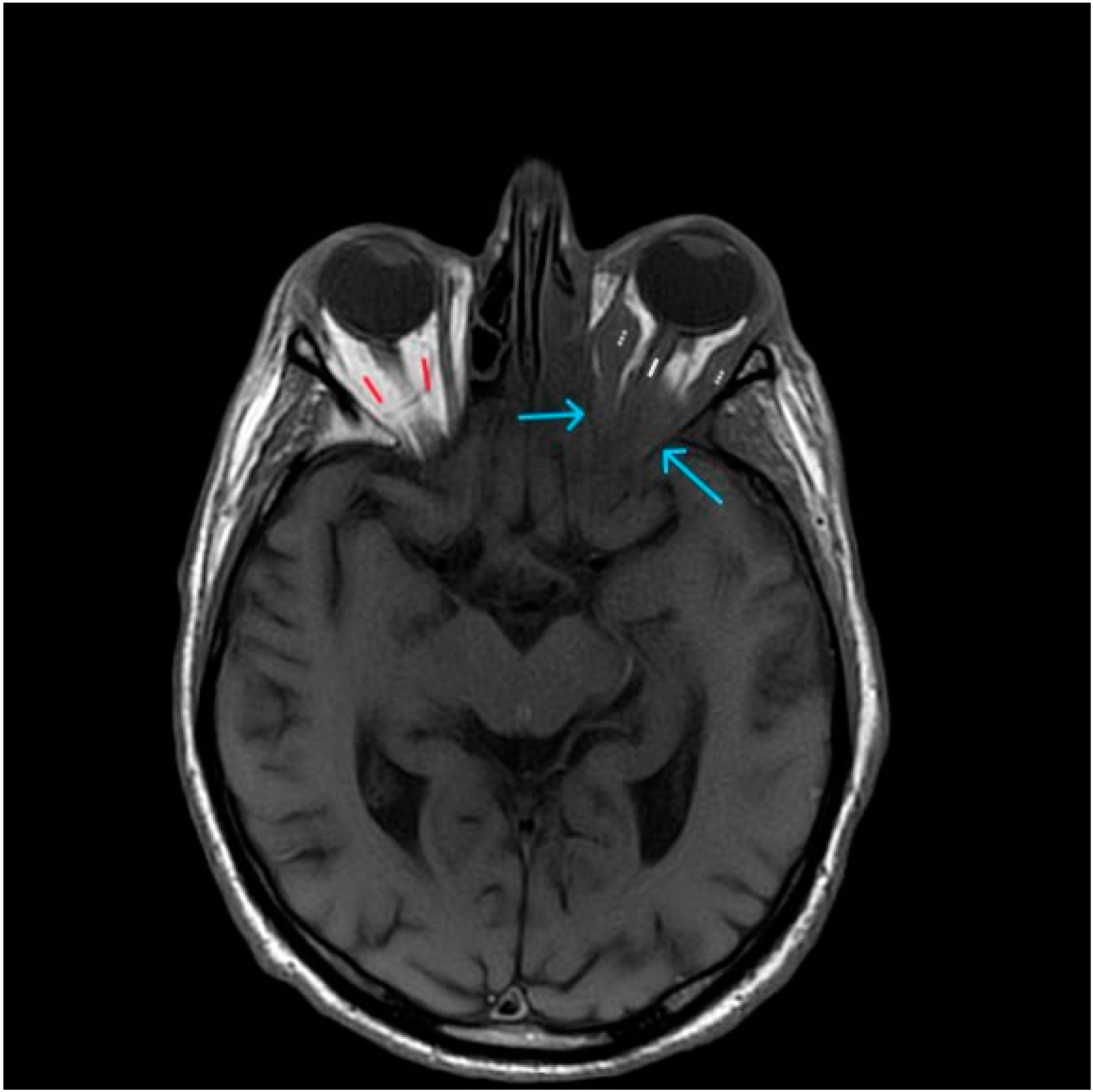 Diagnostics 14 00932 g003
