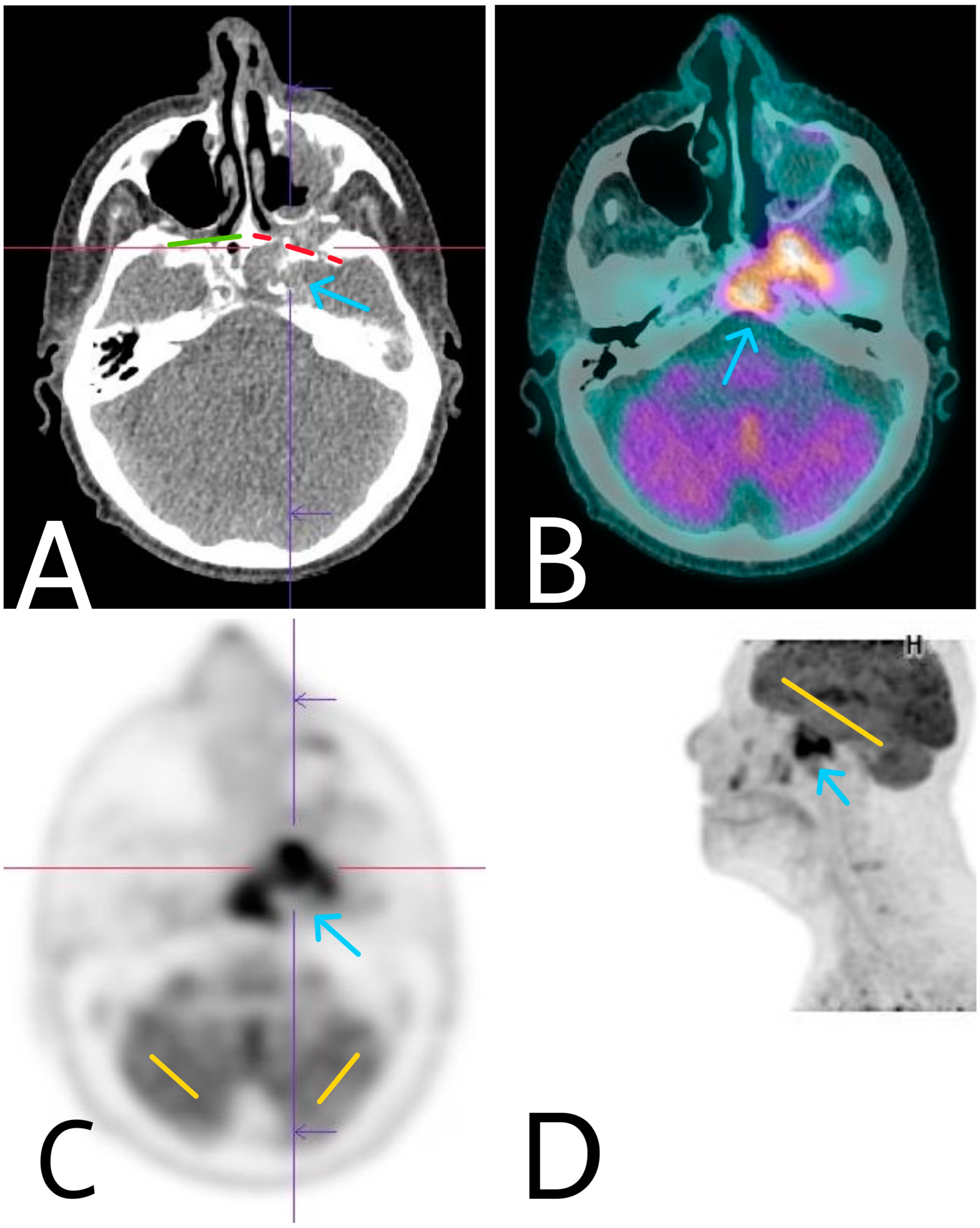 Diagnostics 14 00932 g004