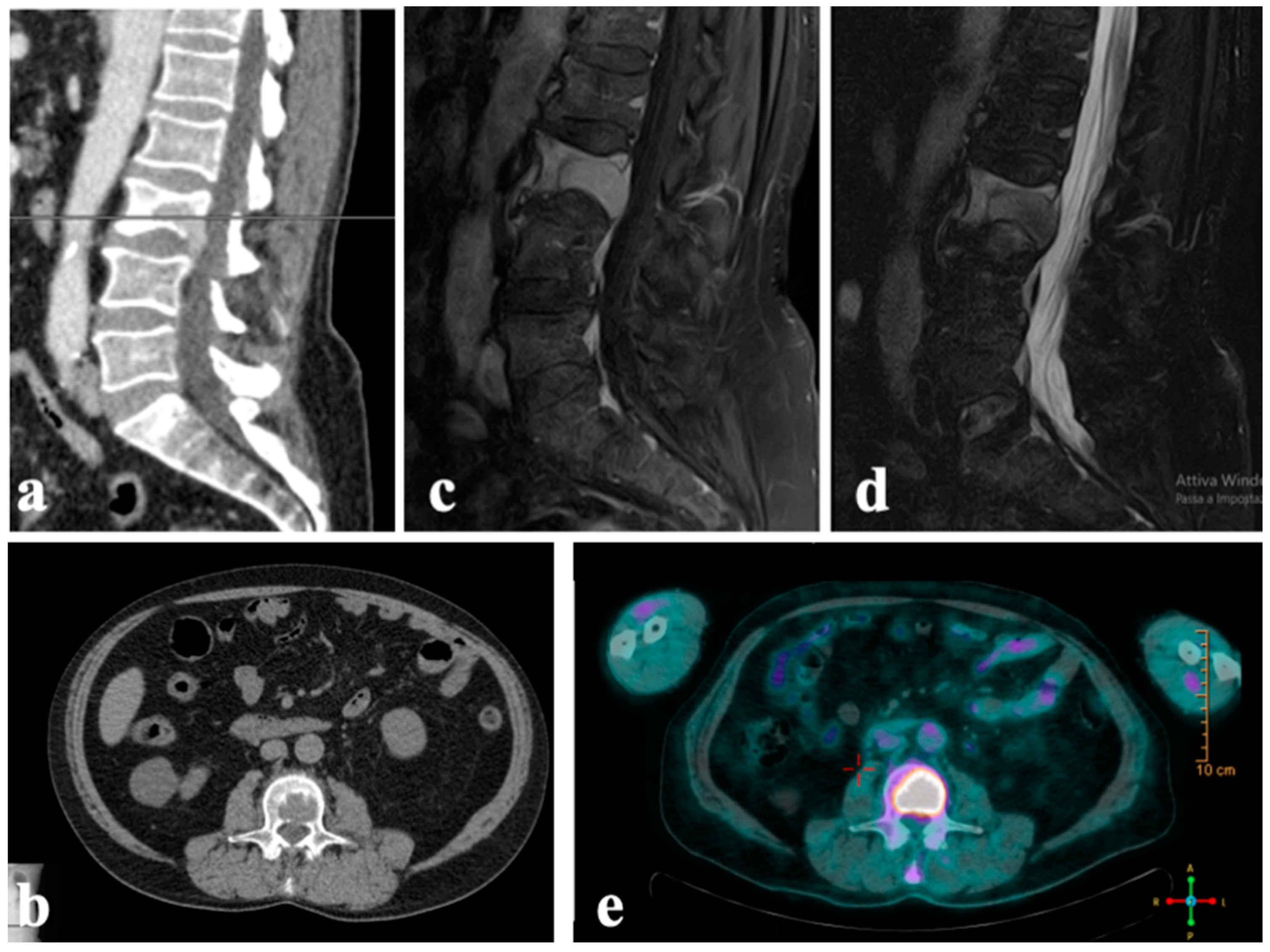 Diagnostics 14 00936 g003