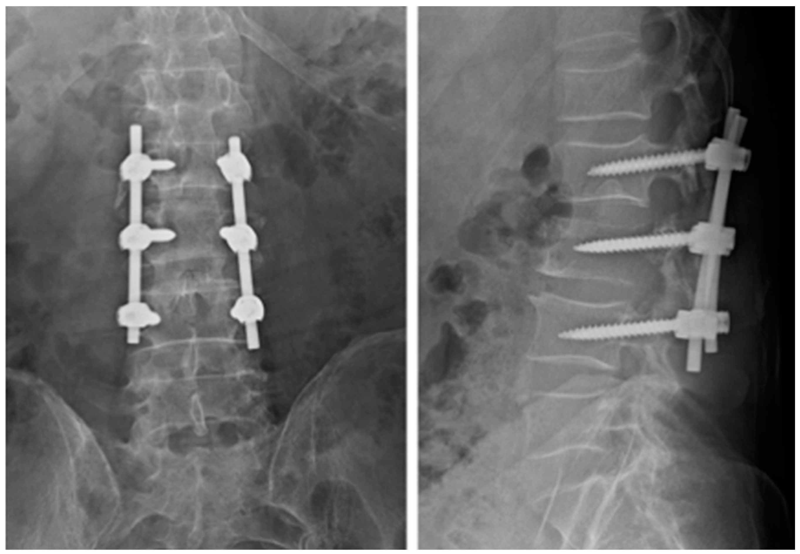 Diagnostics 14 00936 g005