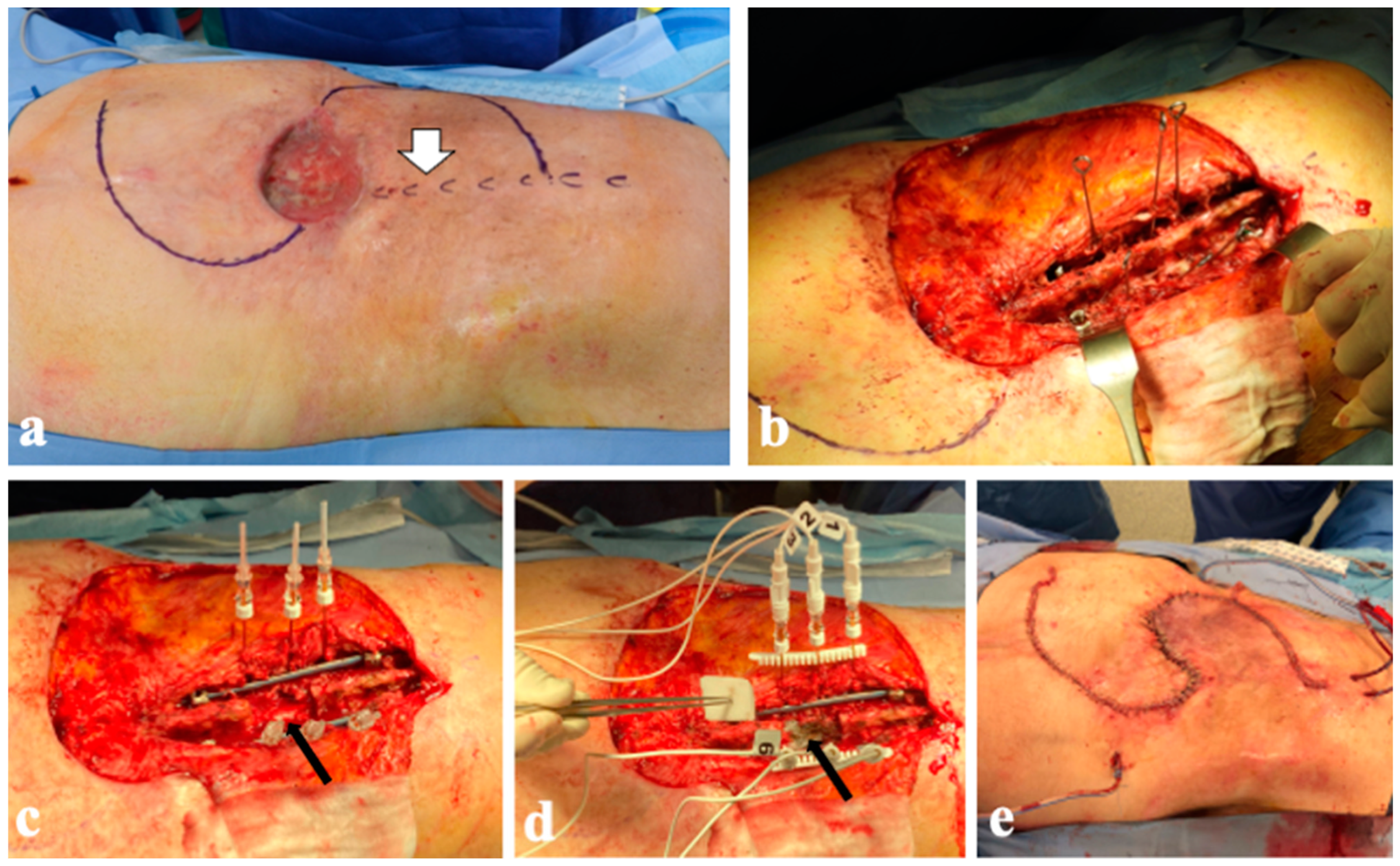 Diagnostics 14 00936 g007