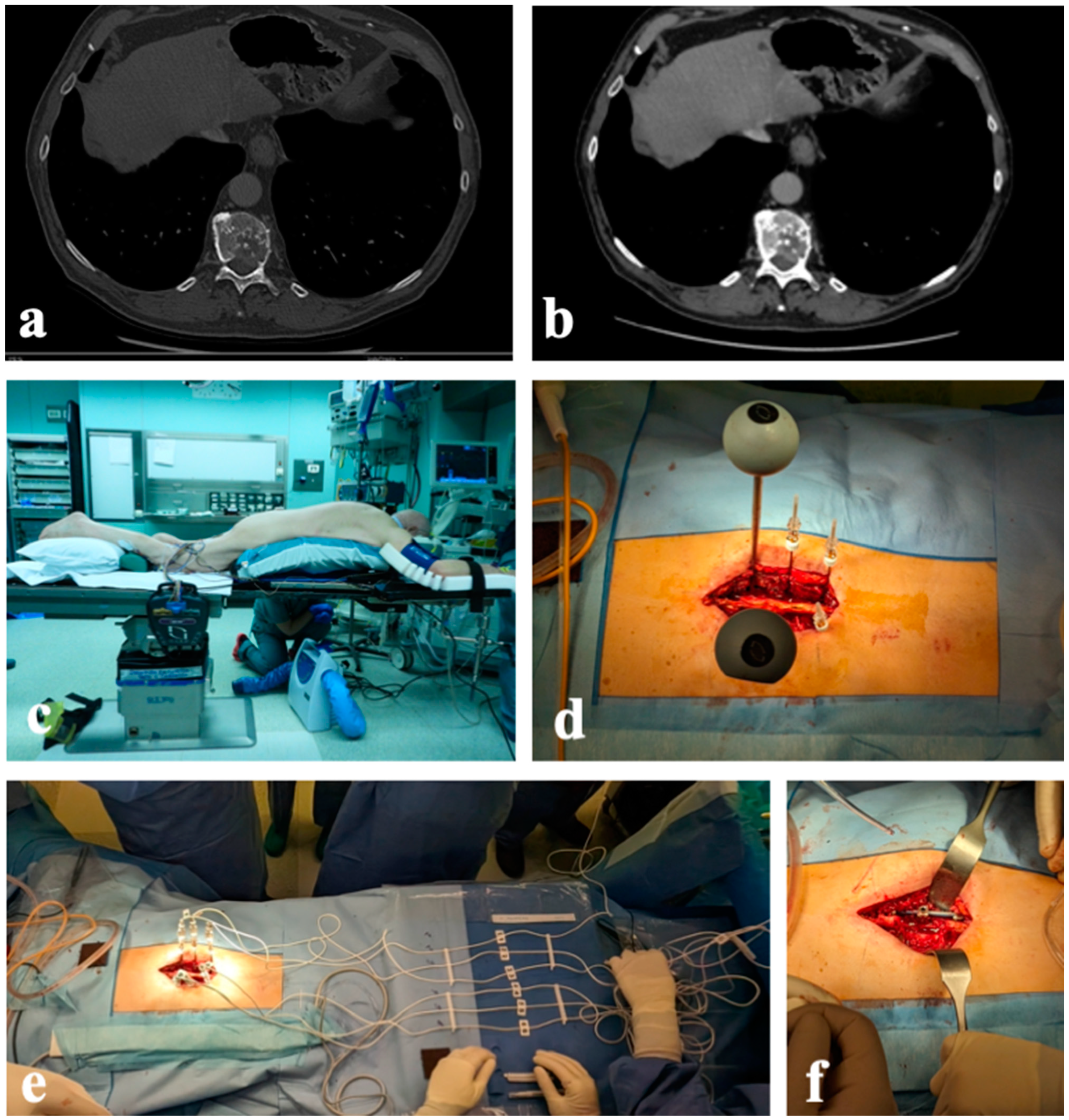 Diagnostics 14 00936 g008