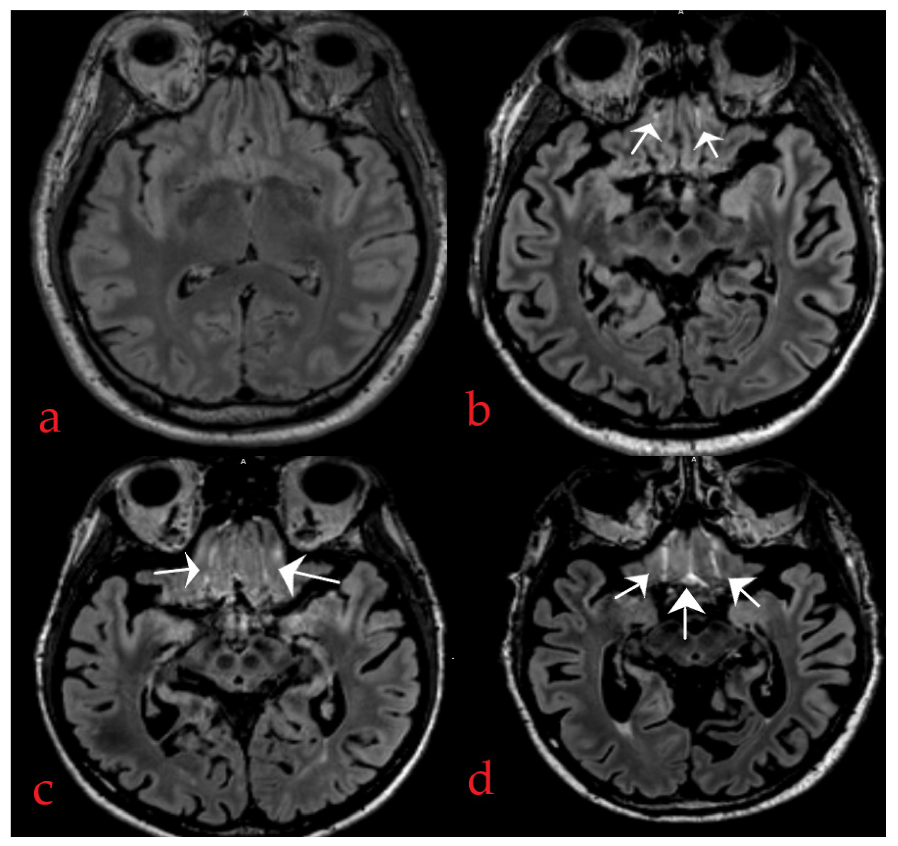Diagnostics 14 00940 g001