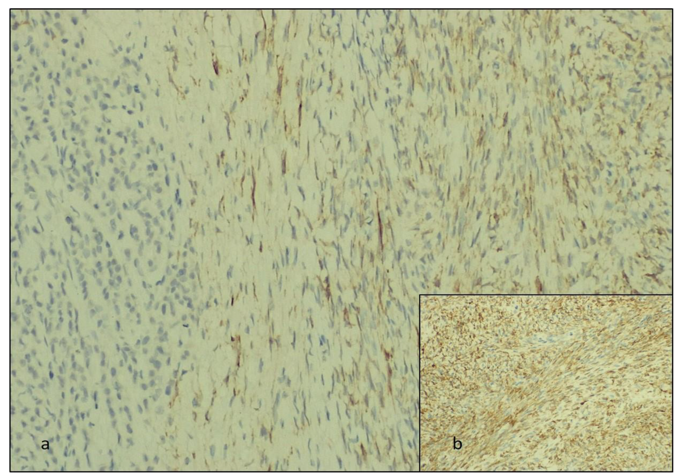 Diagnostics 14 00953 g005 Diagnostics 14 00953 g005