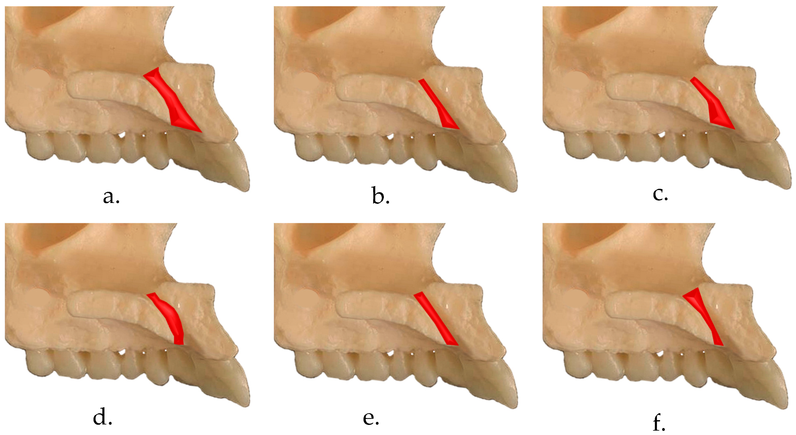 Diagnostics 14 00973 g001