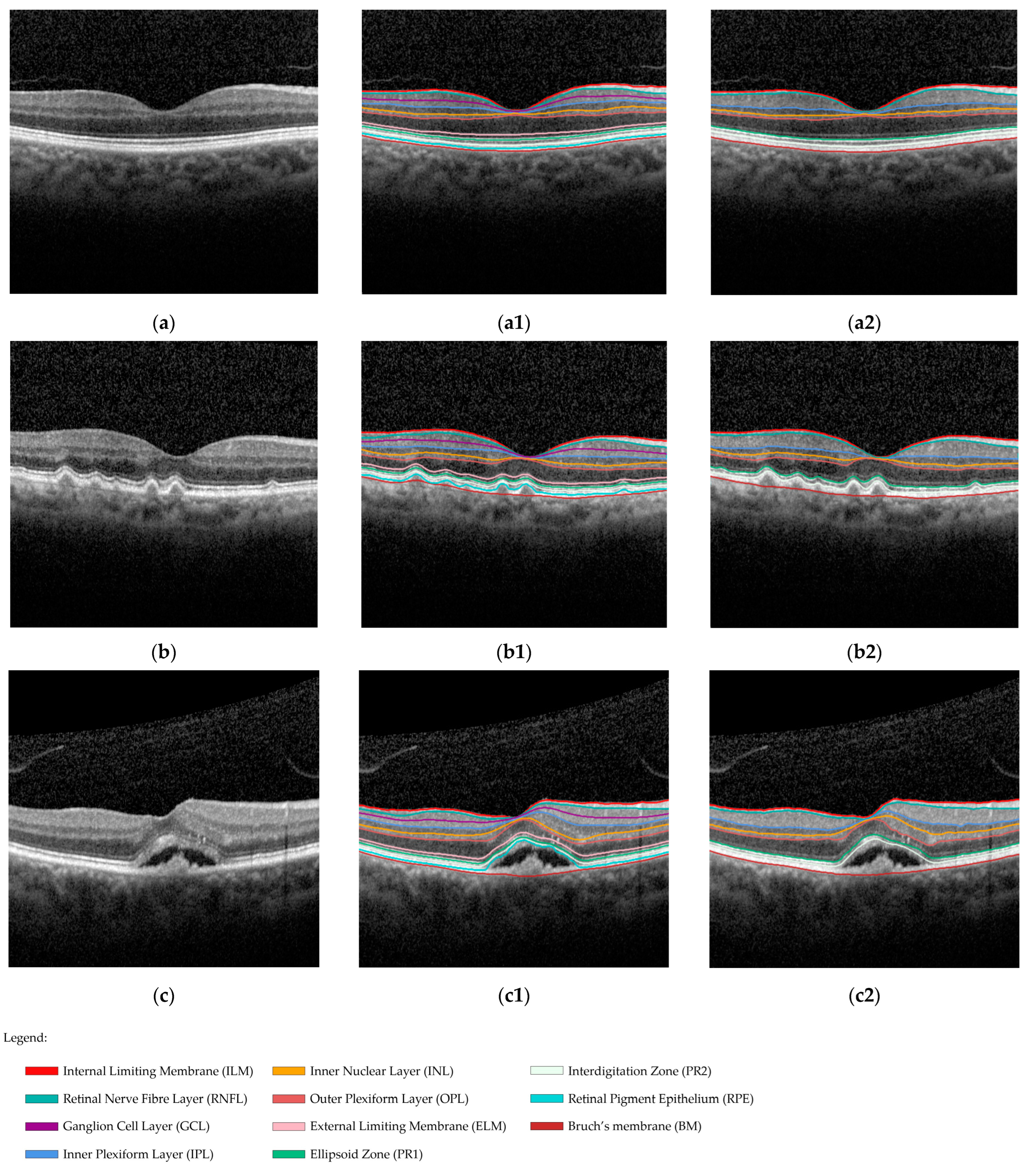 Diagnostics 14 00975 g002