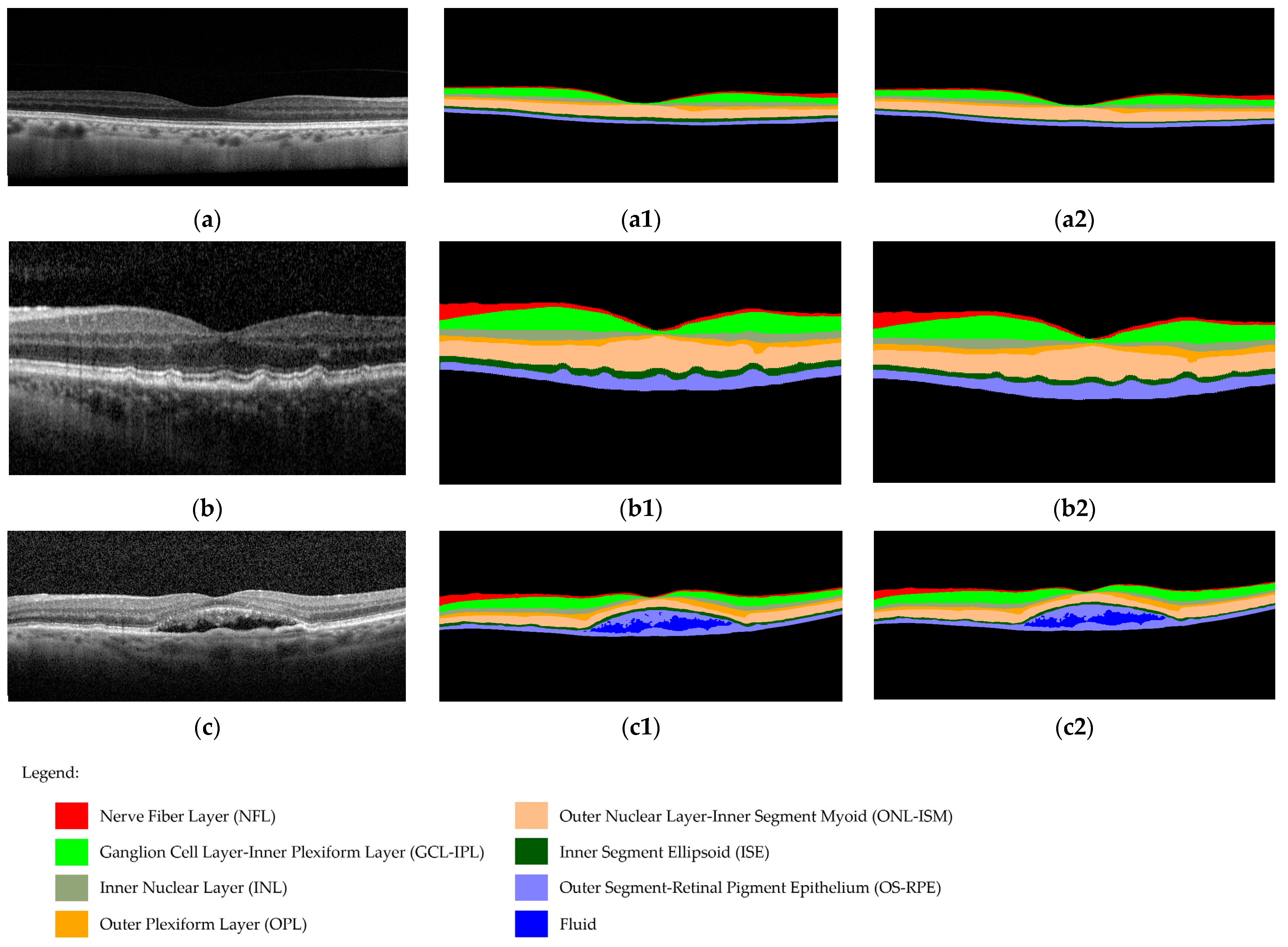 Diagnostics 14 00975 g003