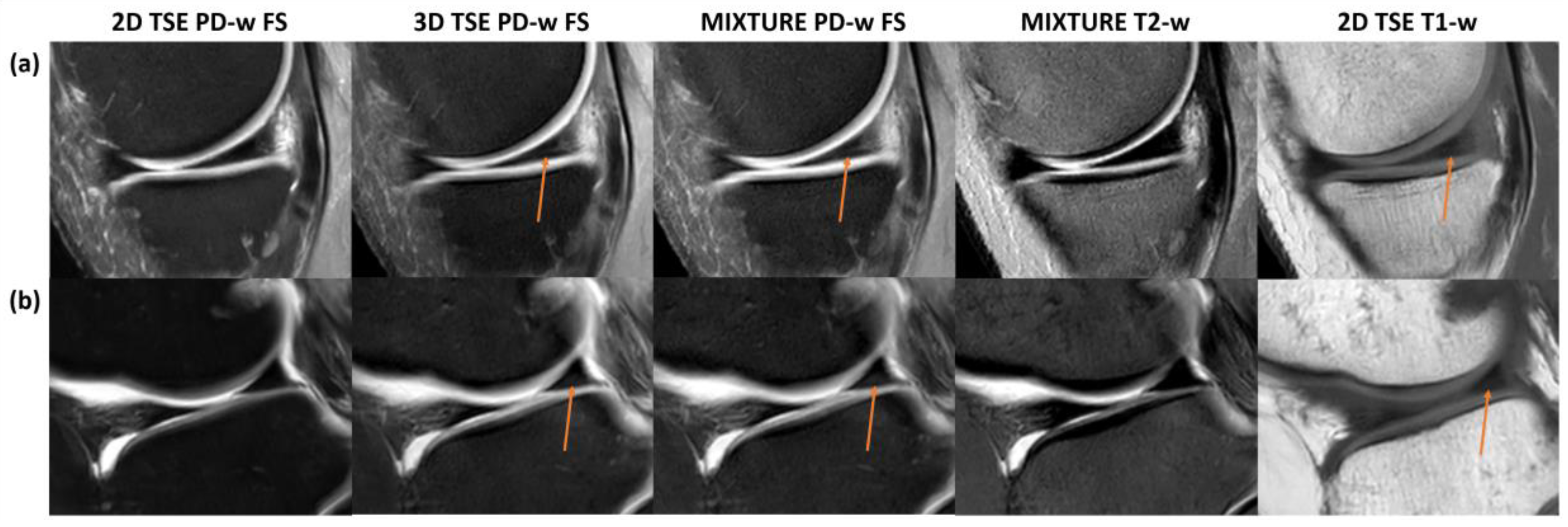 Diagnostics 14 00978 g005