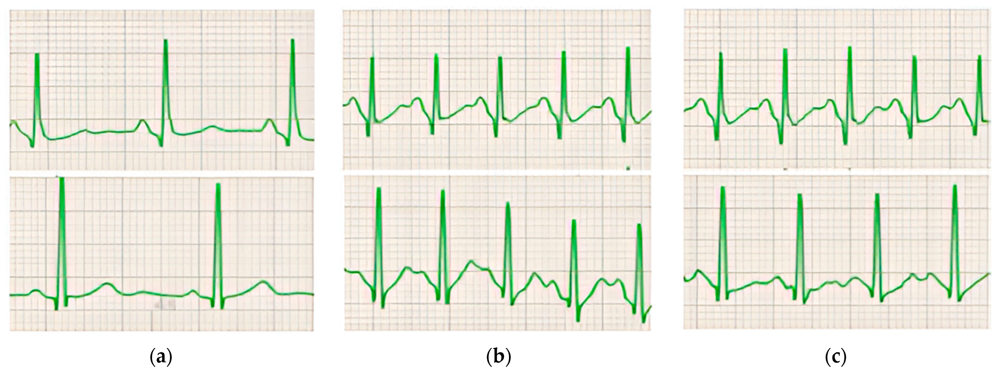Diagnostics 14 00980 g002