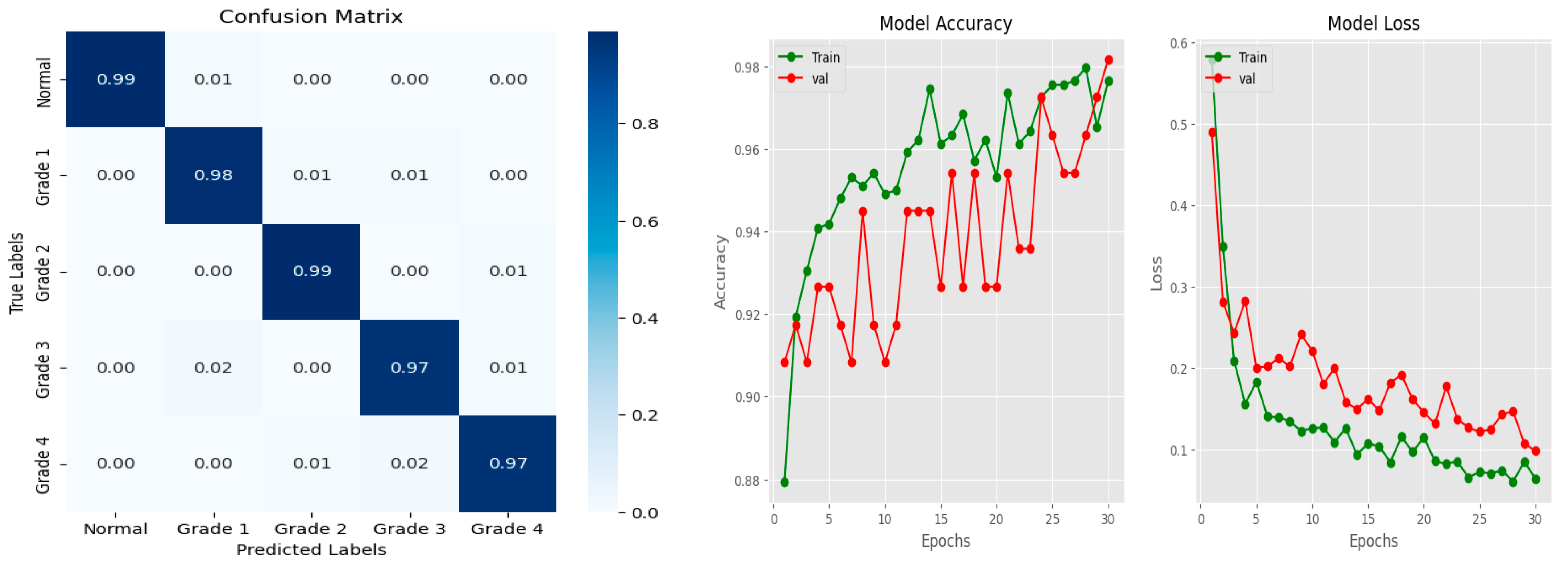 Diagnostics 14 00983 g005