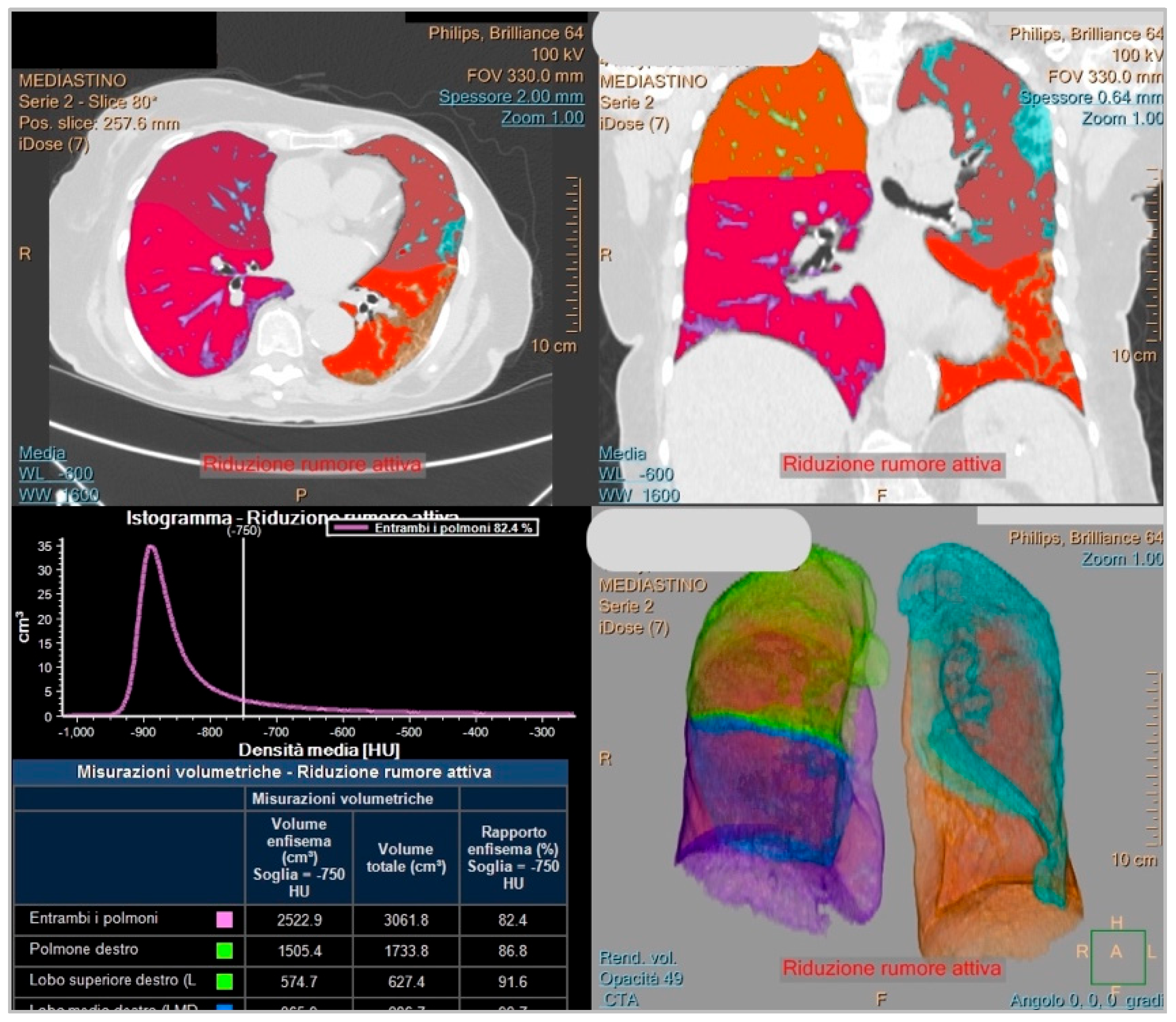 Diagnostics 14 00985 g003
