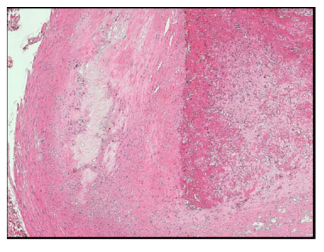 Diagnostics 14 00989 g001