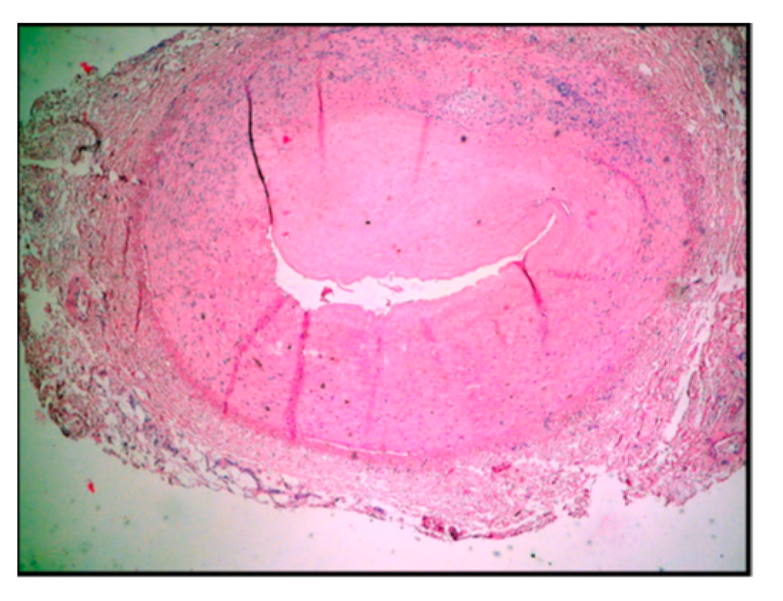 Diagnostics 14 00989 g004