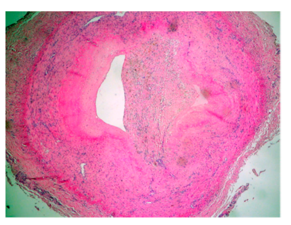 Diagnostics 14 00989 g005