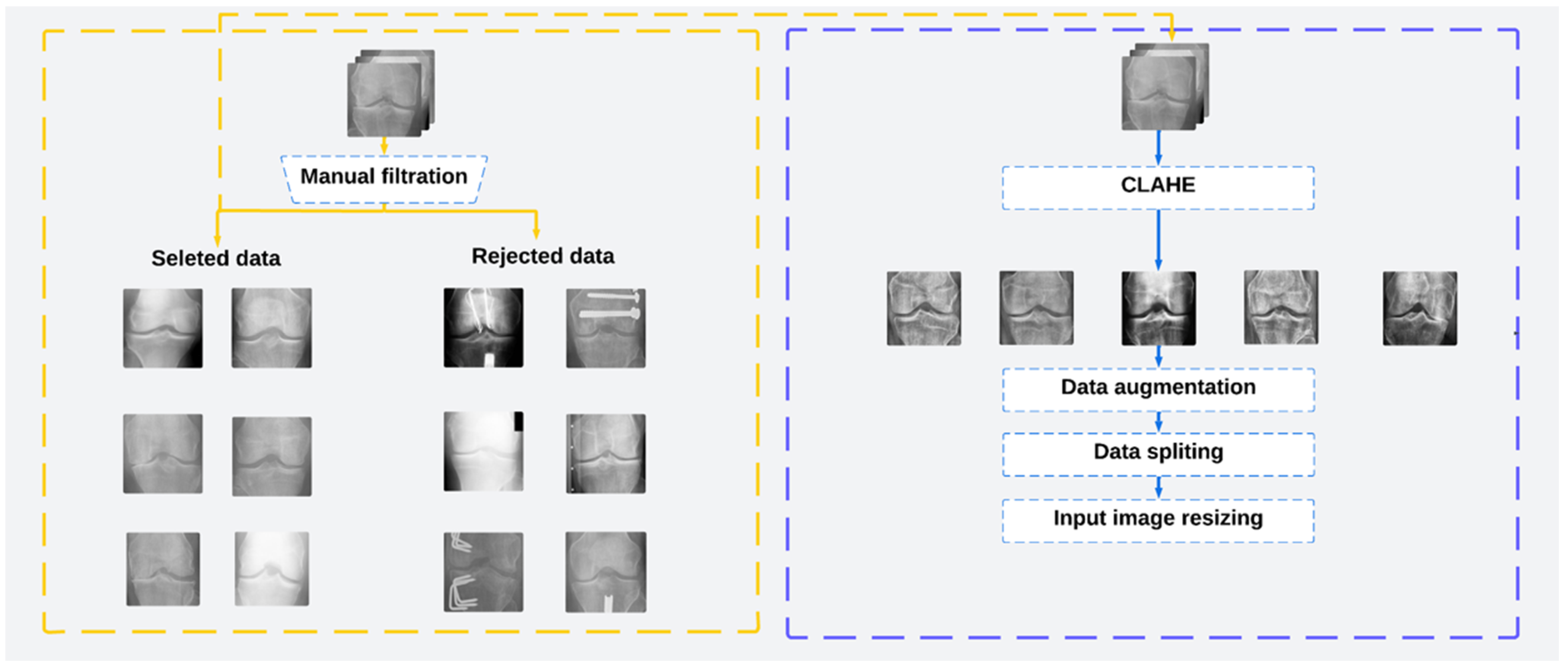 Diagnostics 14 00993 g001
