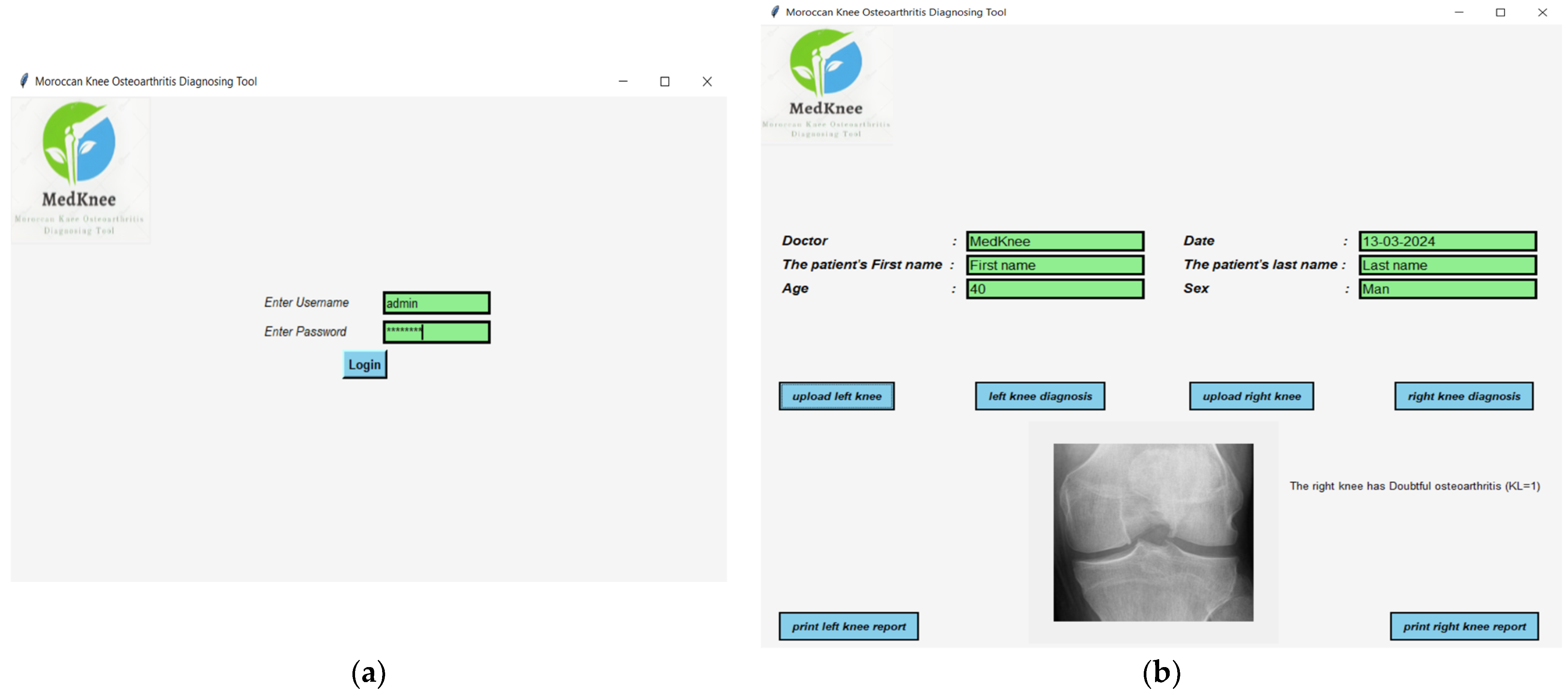Diagnostics 14 00993 g004