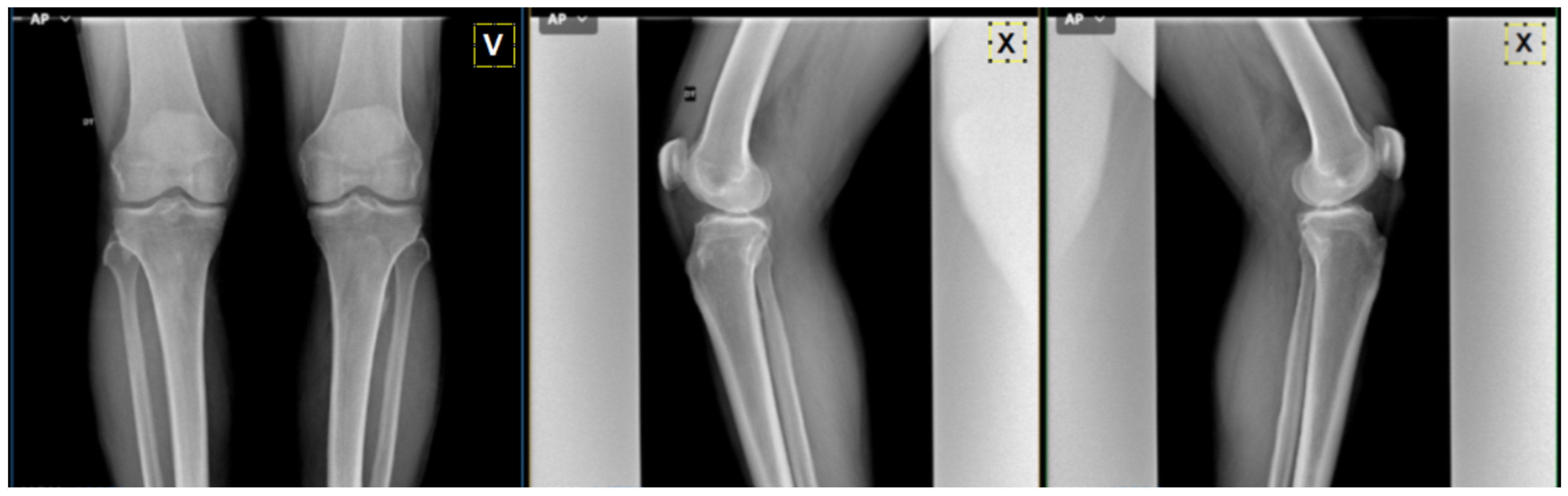 Diagnostics 14 00993 g007