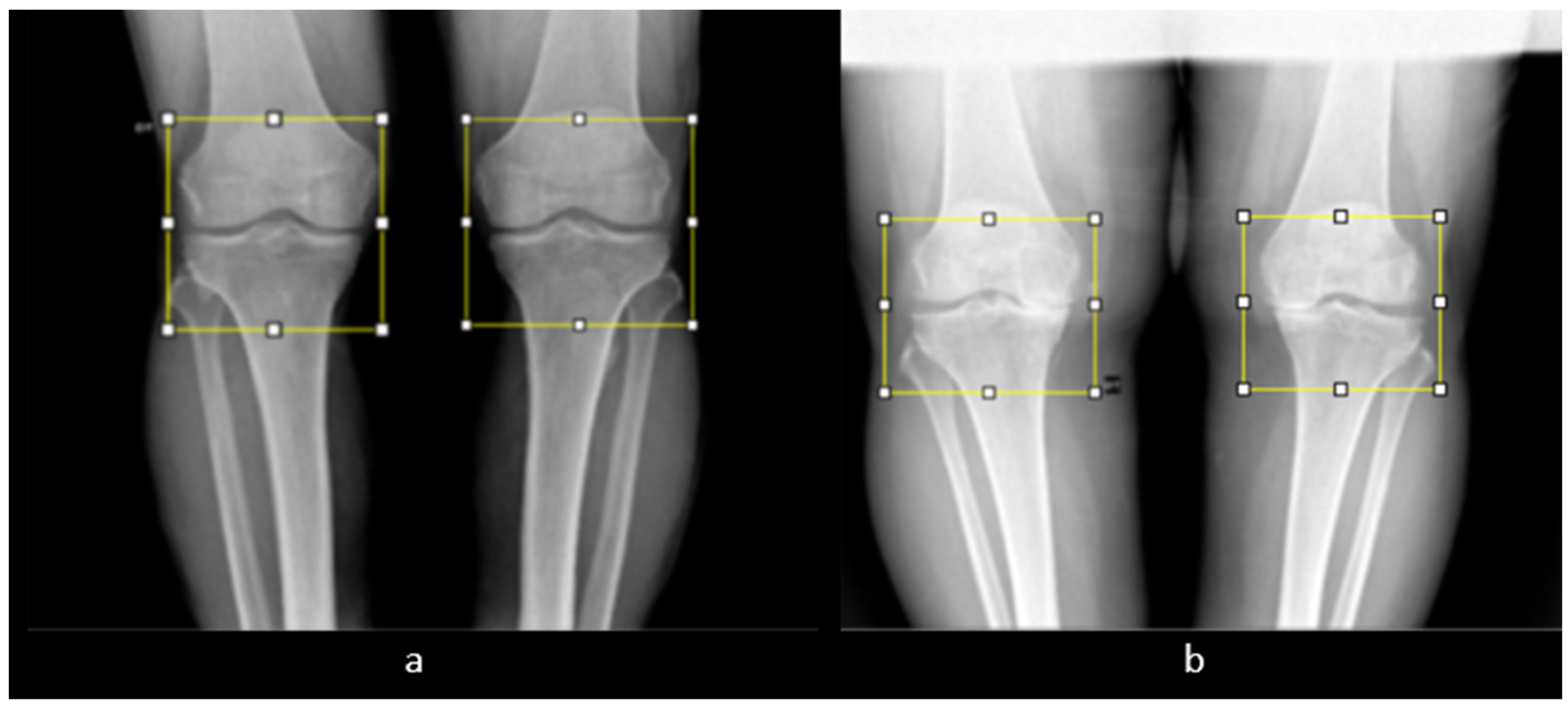 Diagnostics 14 00993 g008