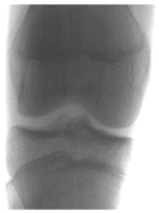 Diagnostics 14 00993 i001