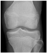 Diagnostics 14 00993 i007