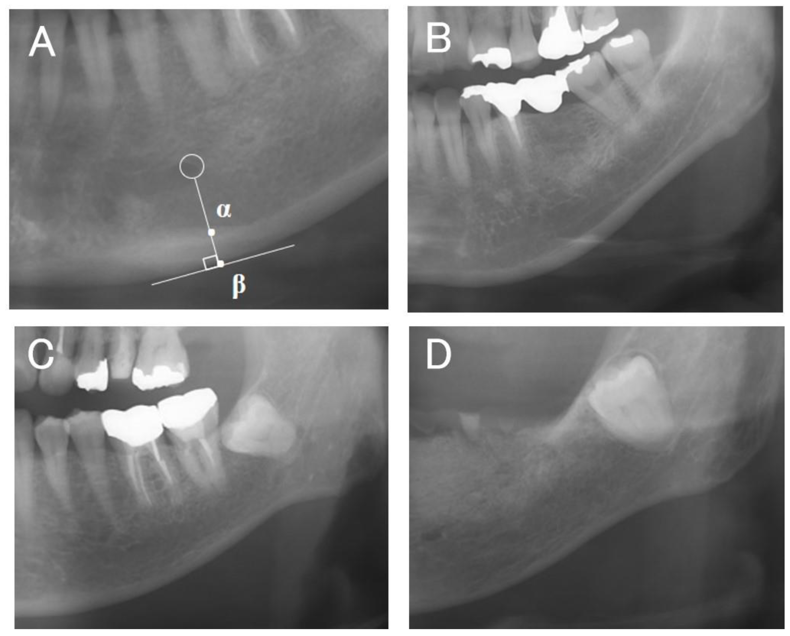 Diagnostics 14 01009 g002