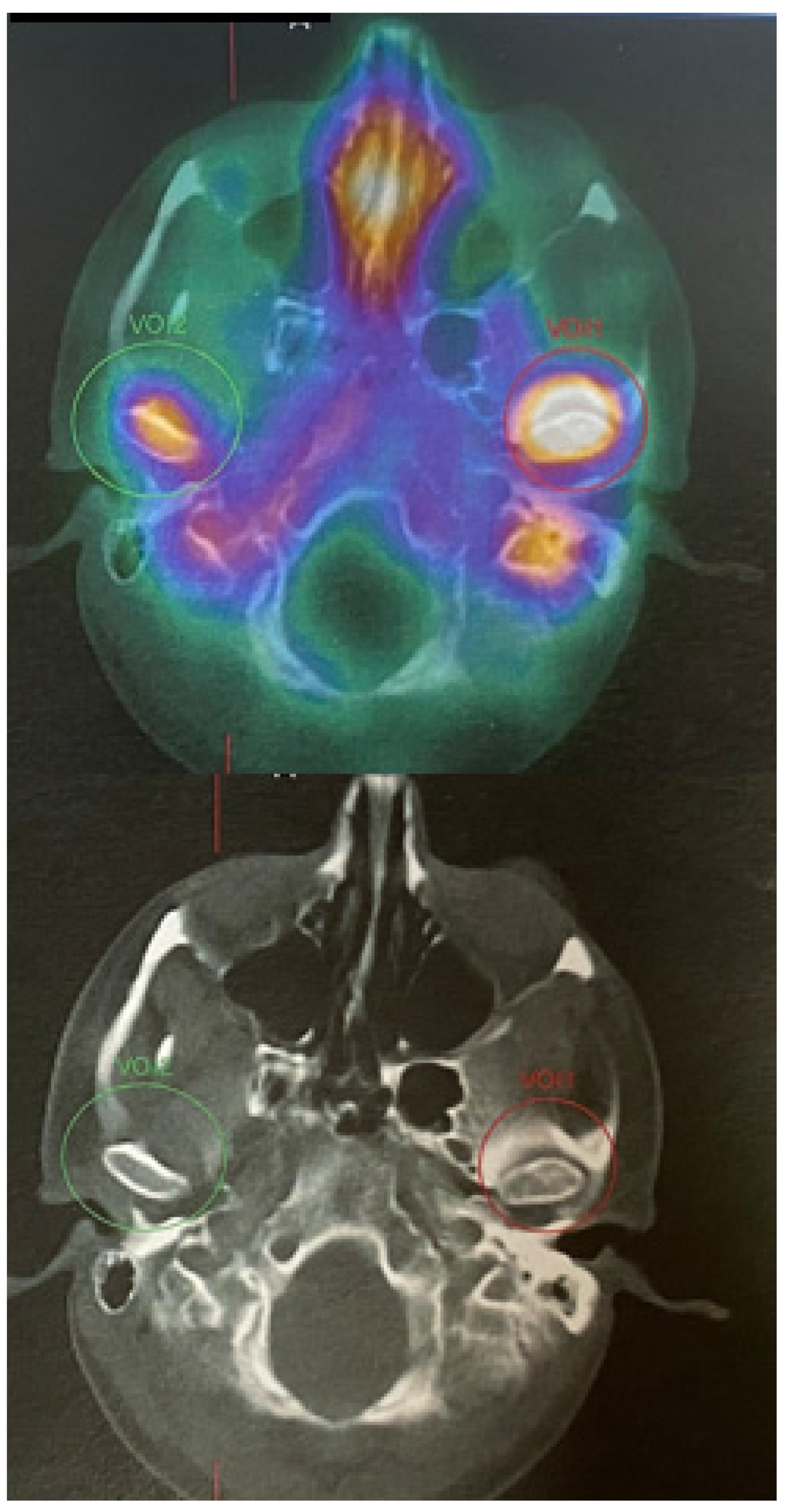 Diagnostics 14 01014 g004