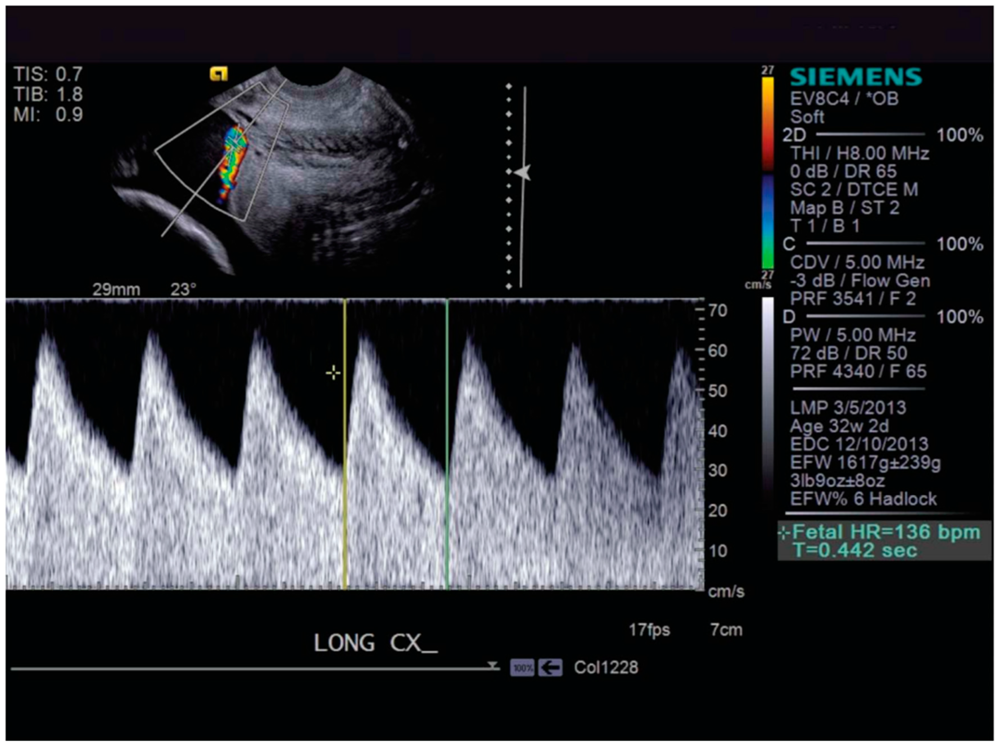 Diagnostics 14 01016 g001