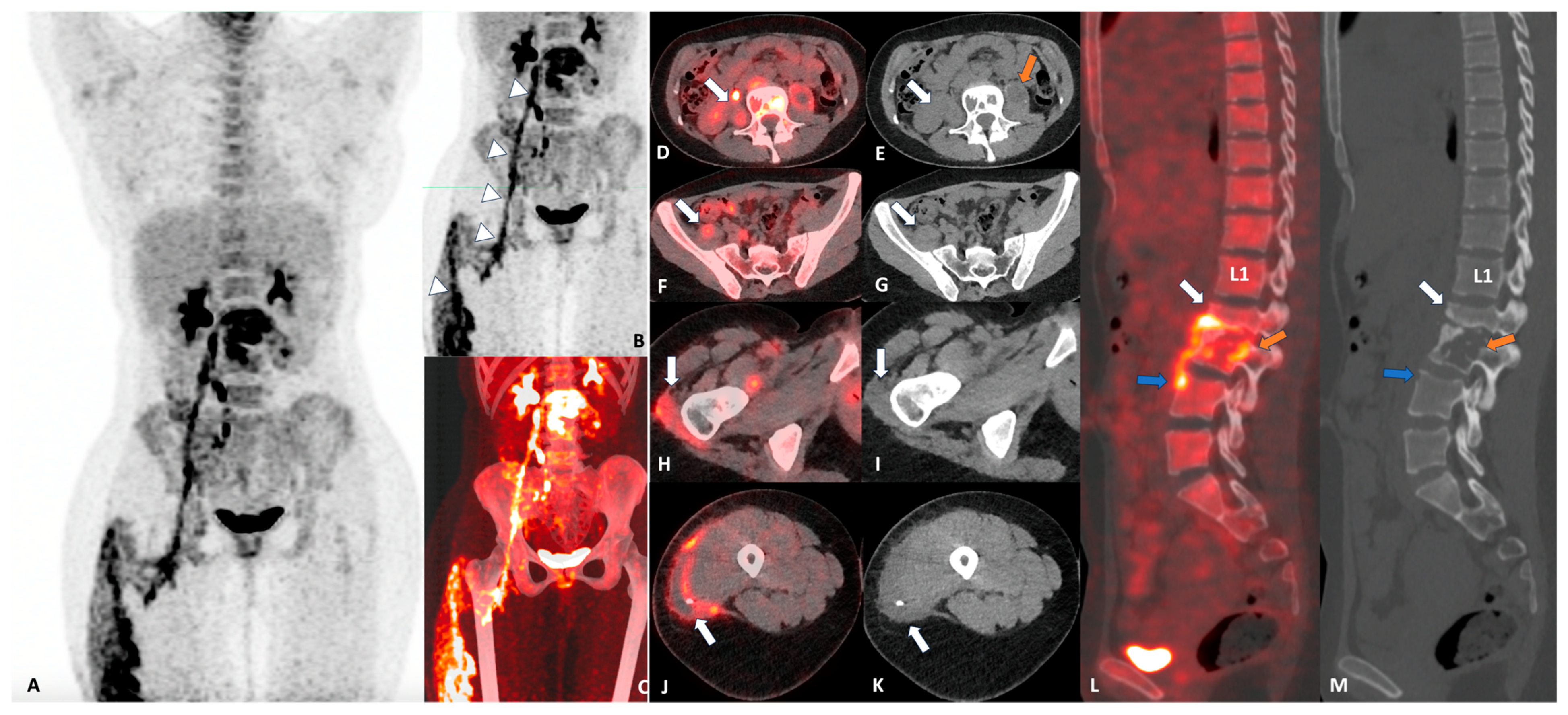 Diagnostics 14 01018 g001 Diagnostics 14 01018 g001
