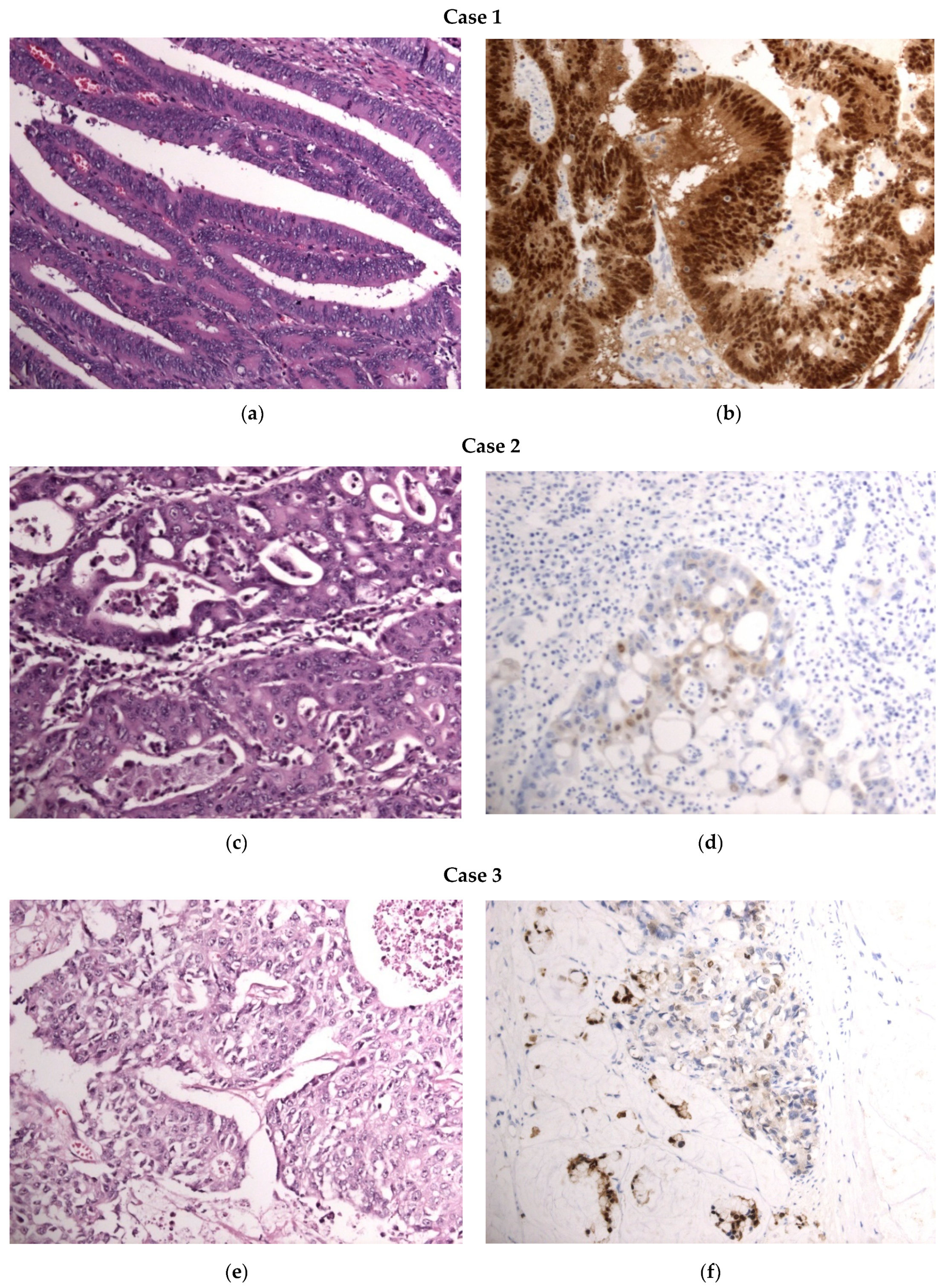 Diagnostics 14 01023 g001