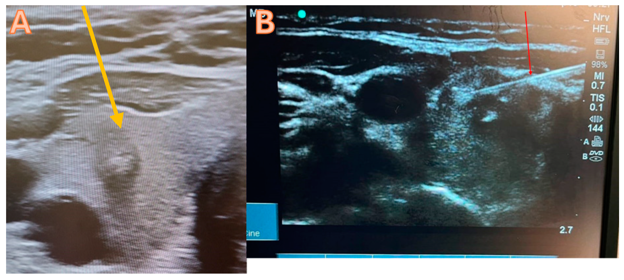 Diagnostics 14 01026 g001