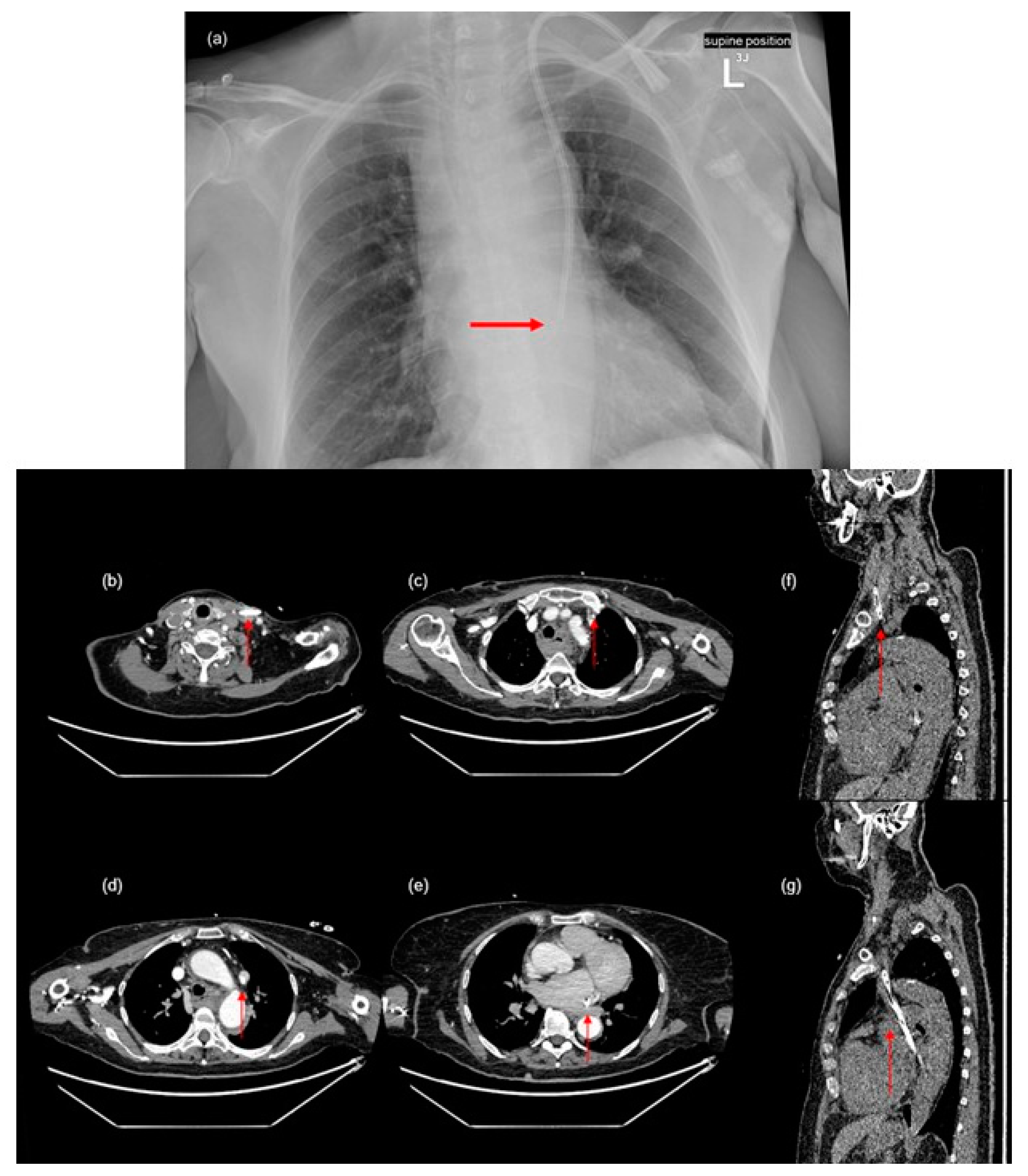 Diagnostics 14 01038 g001