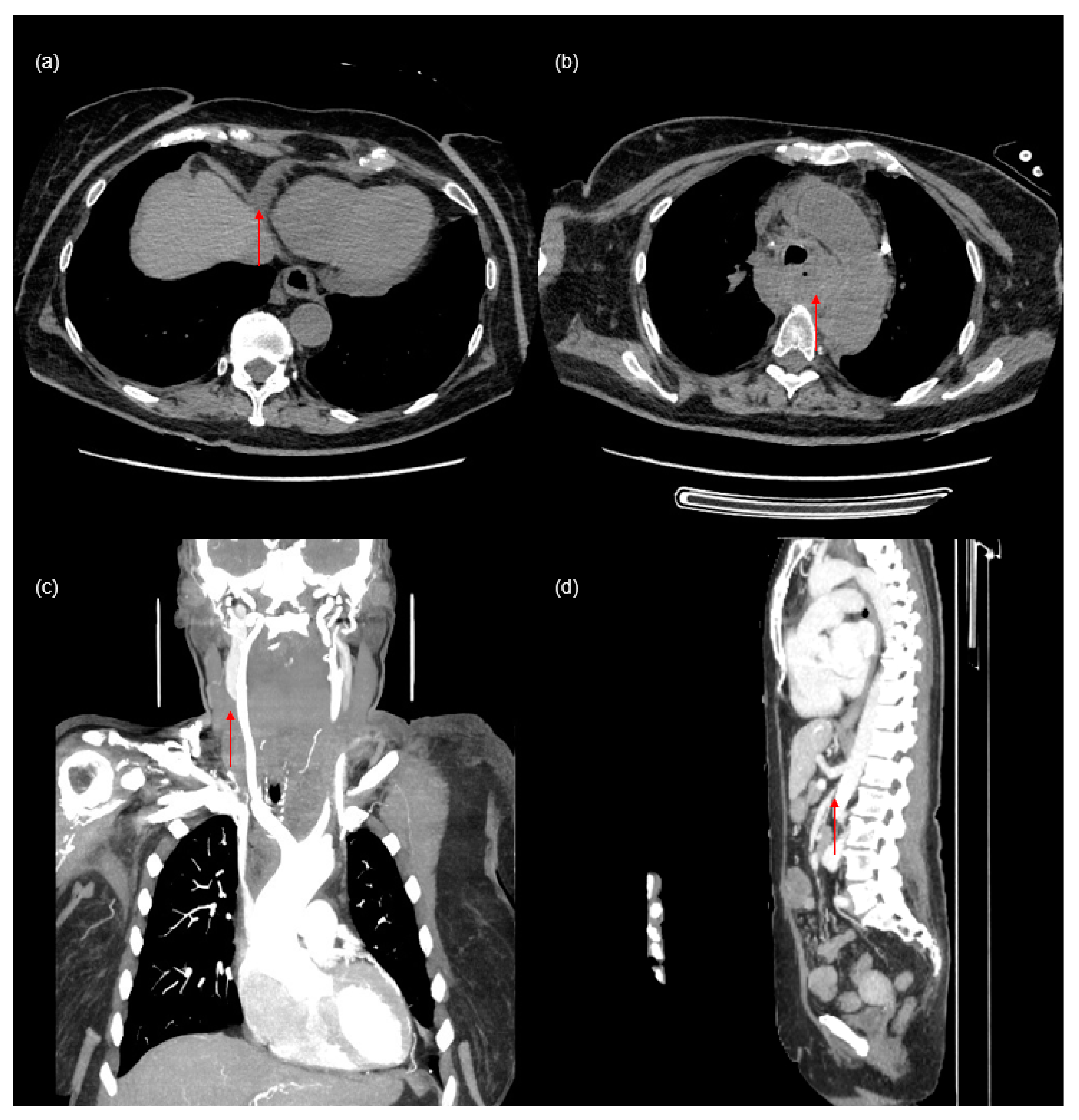 Diagnostics 14 01038 g002
