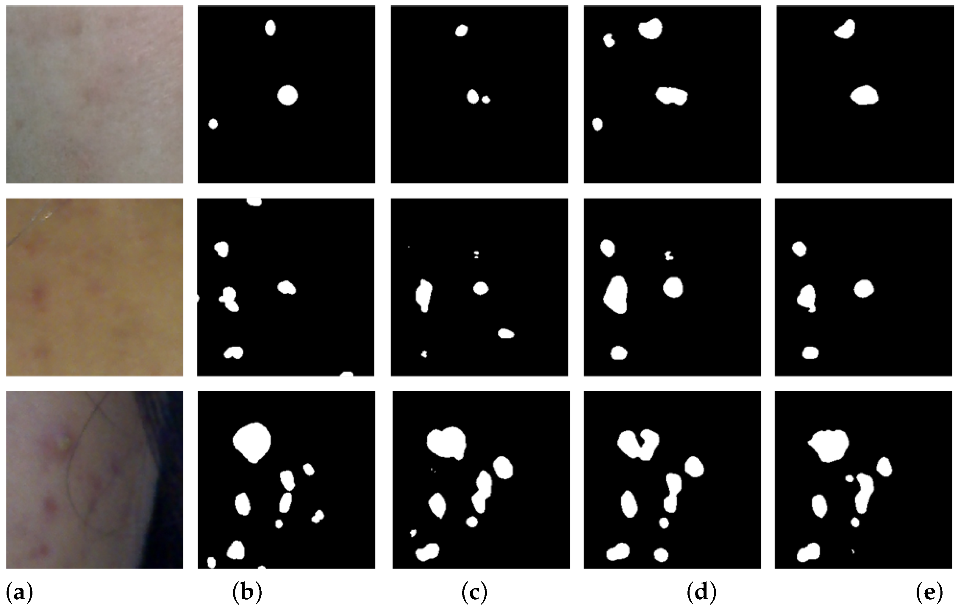 Diagnostics 14 01040 g004
