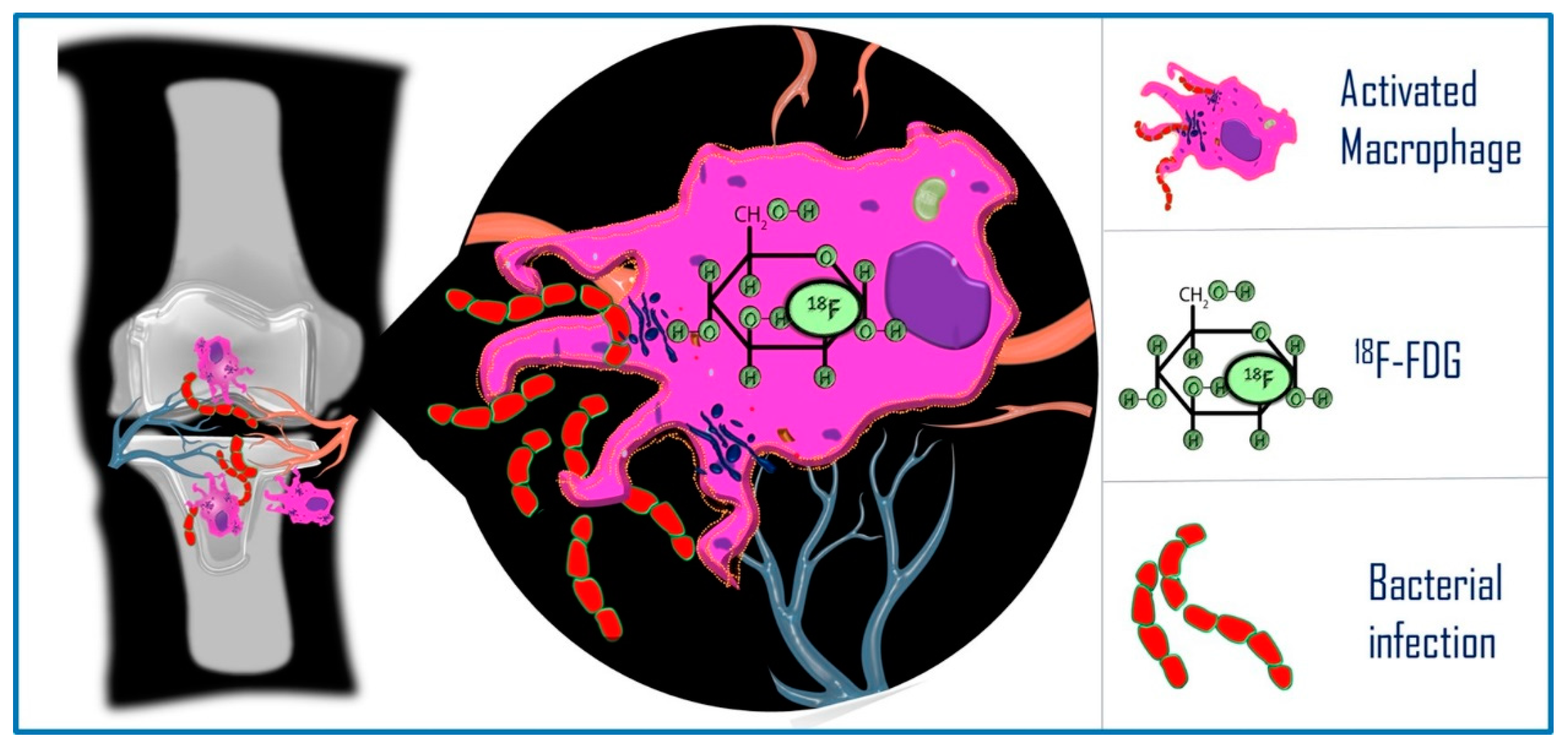 Diagnostics 14 01043 g007 Diagnostics 14 01043 g007