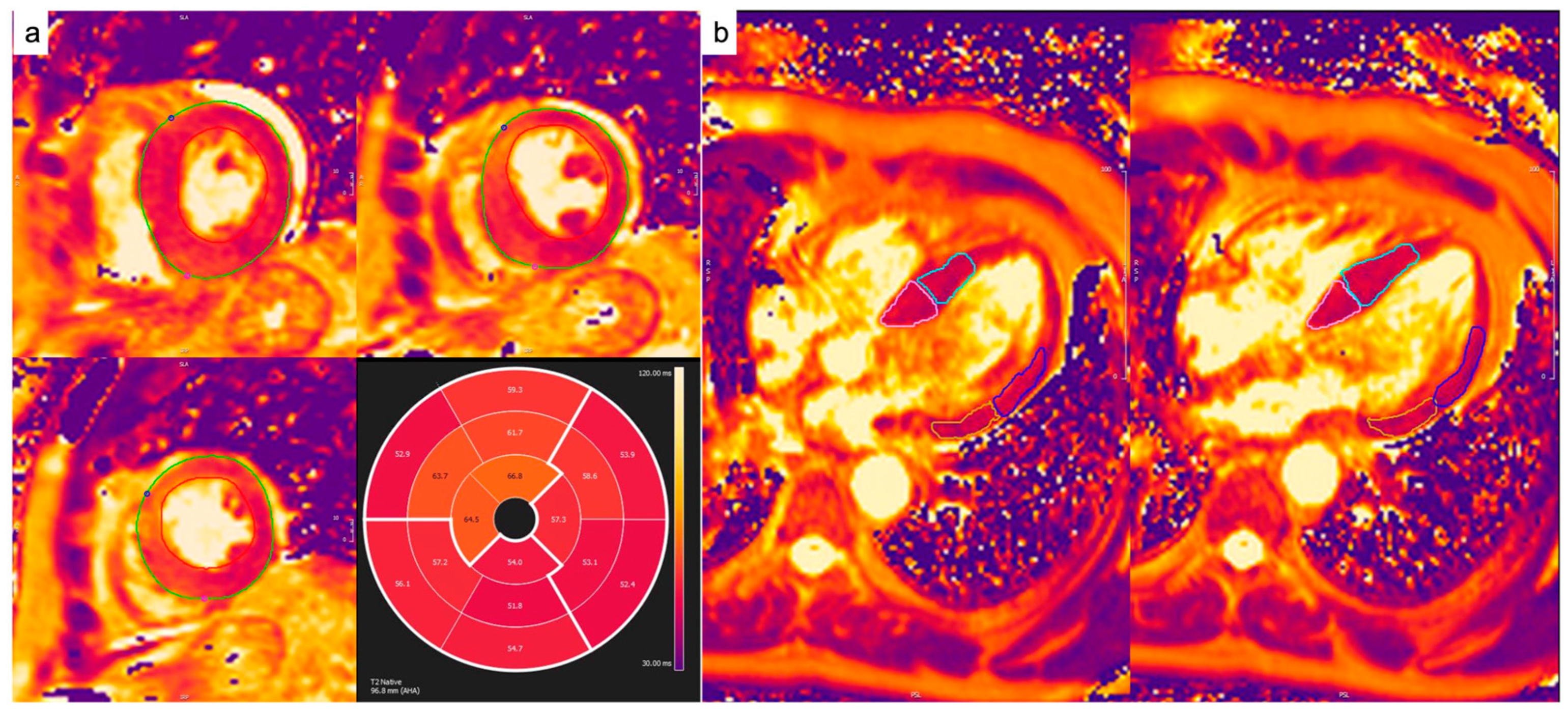 Diagnostics 14 01048 g002