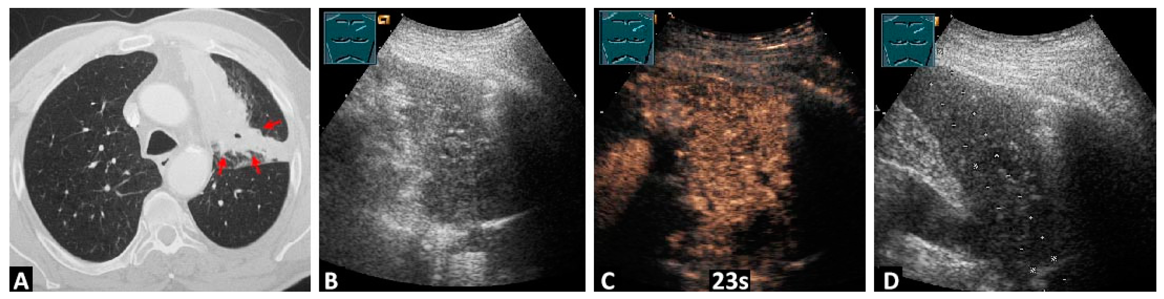 Diagnostics 14 01051 g002