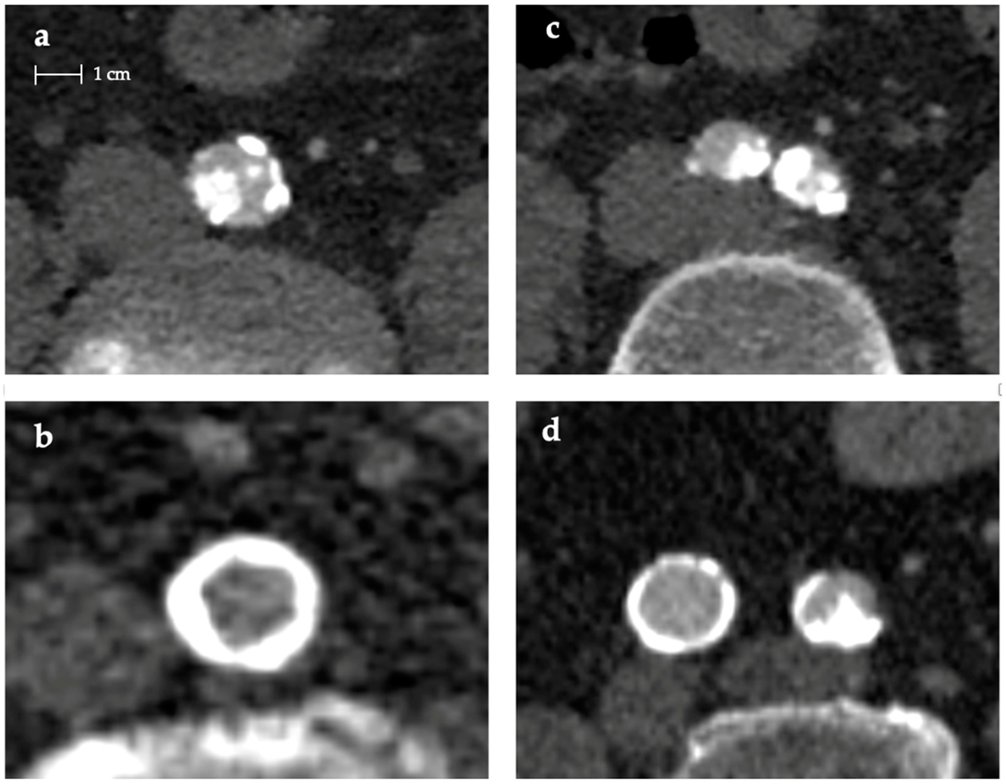 Diagnostics 14 01053 g002