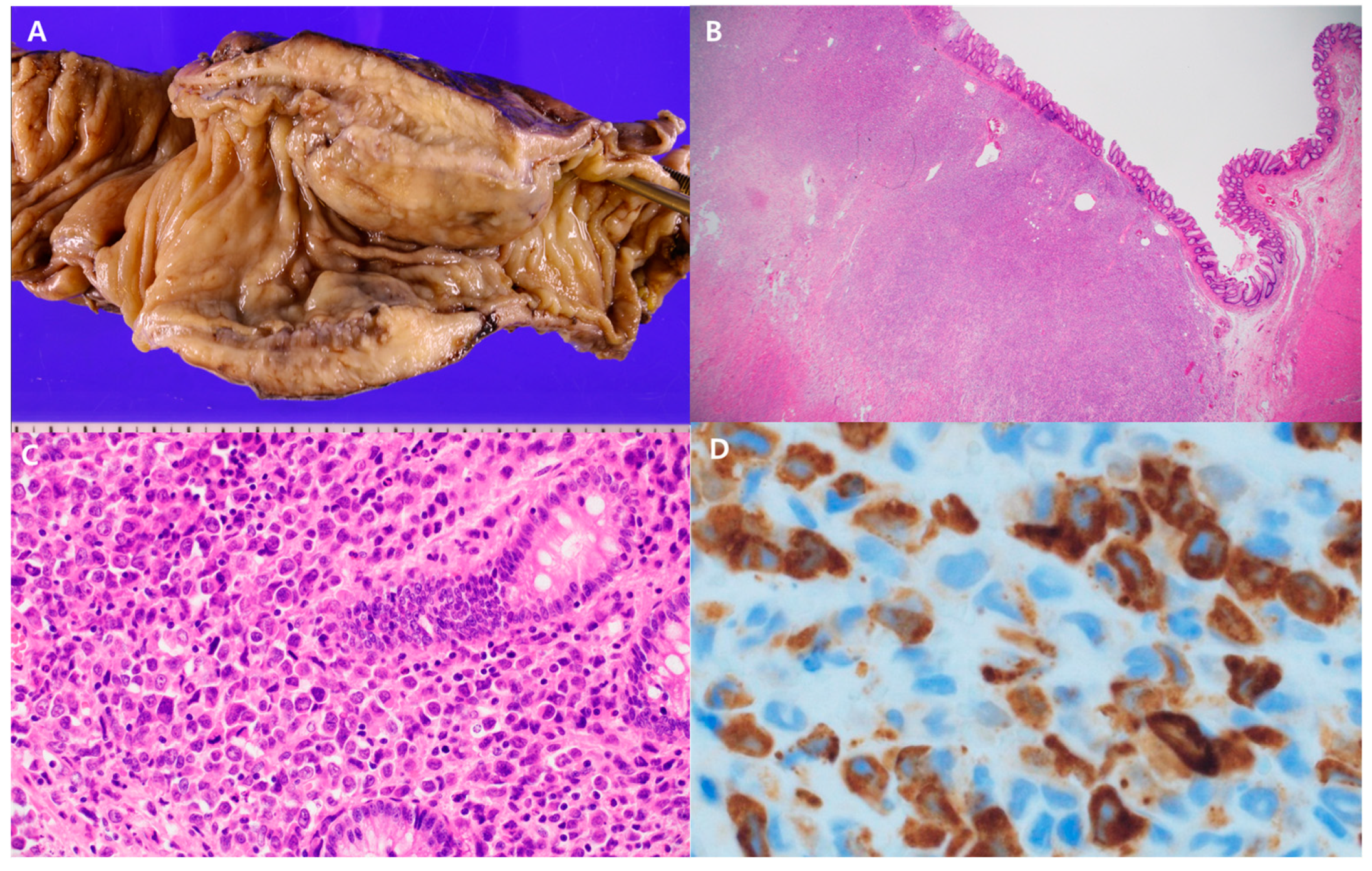 Diagnostics 14 01062 g002