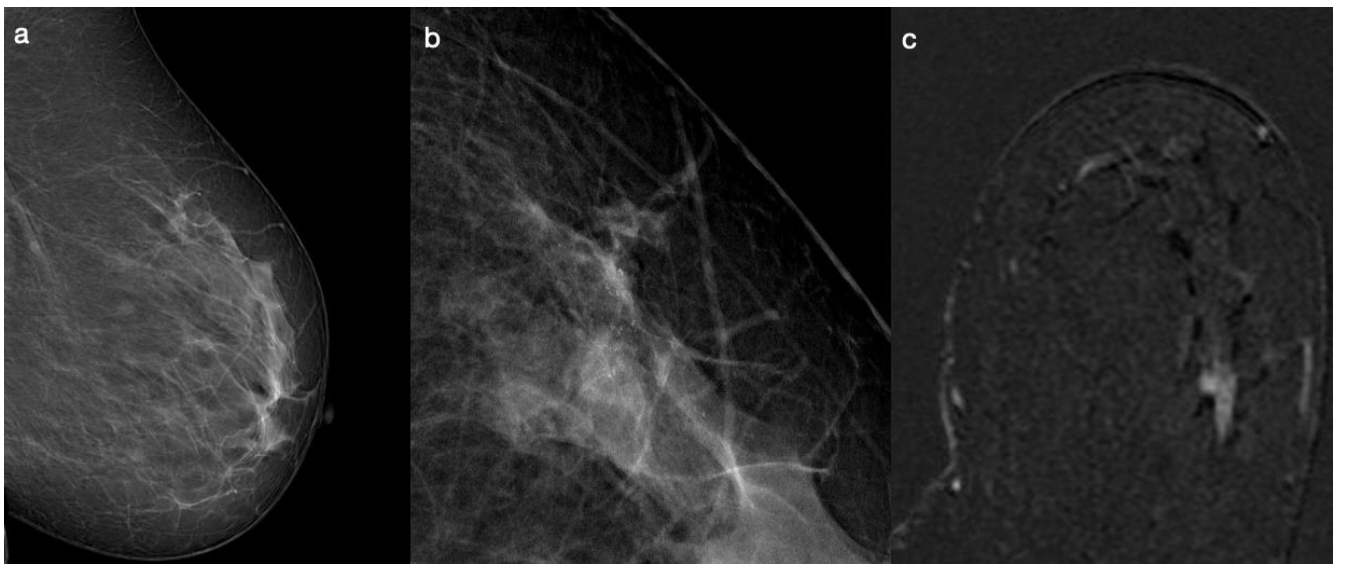 Diagnostics 14 01063 g001