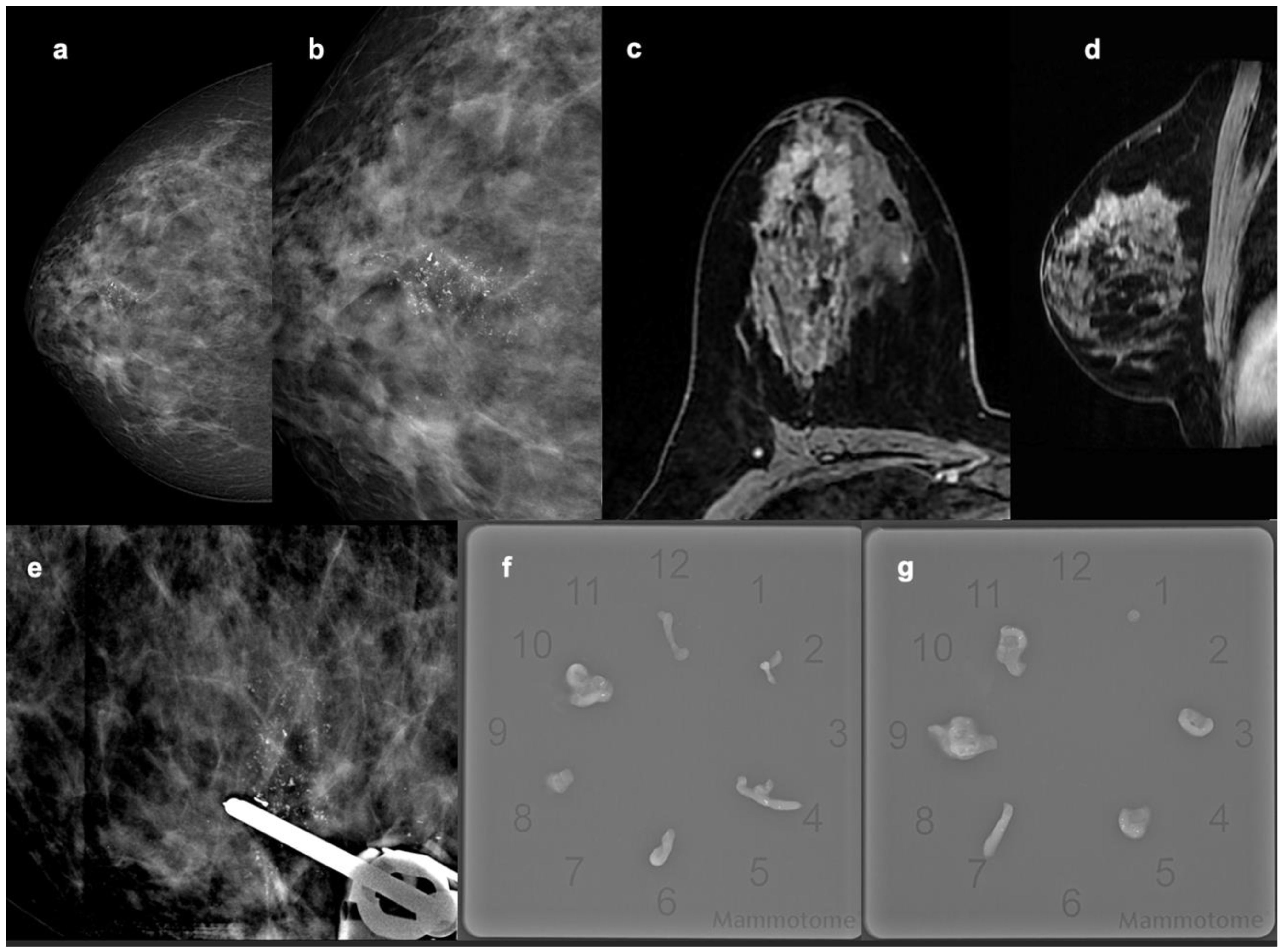 Diagnostics 14 01063 g004