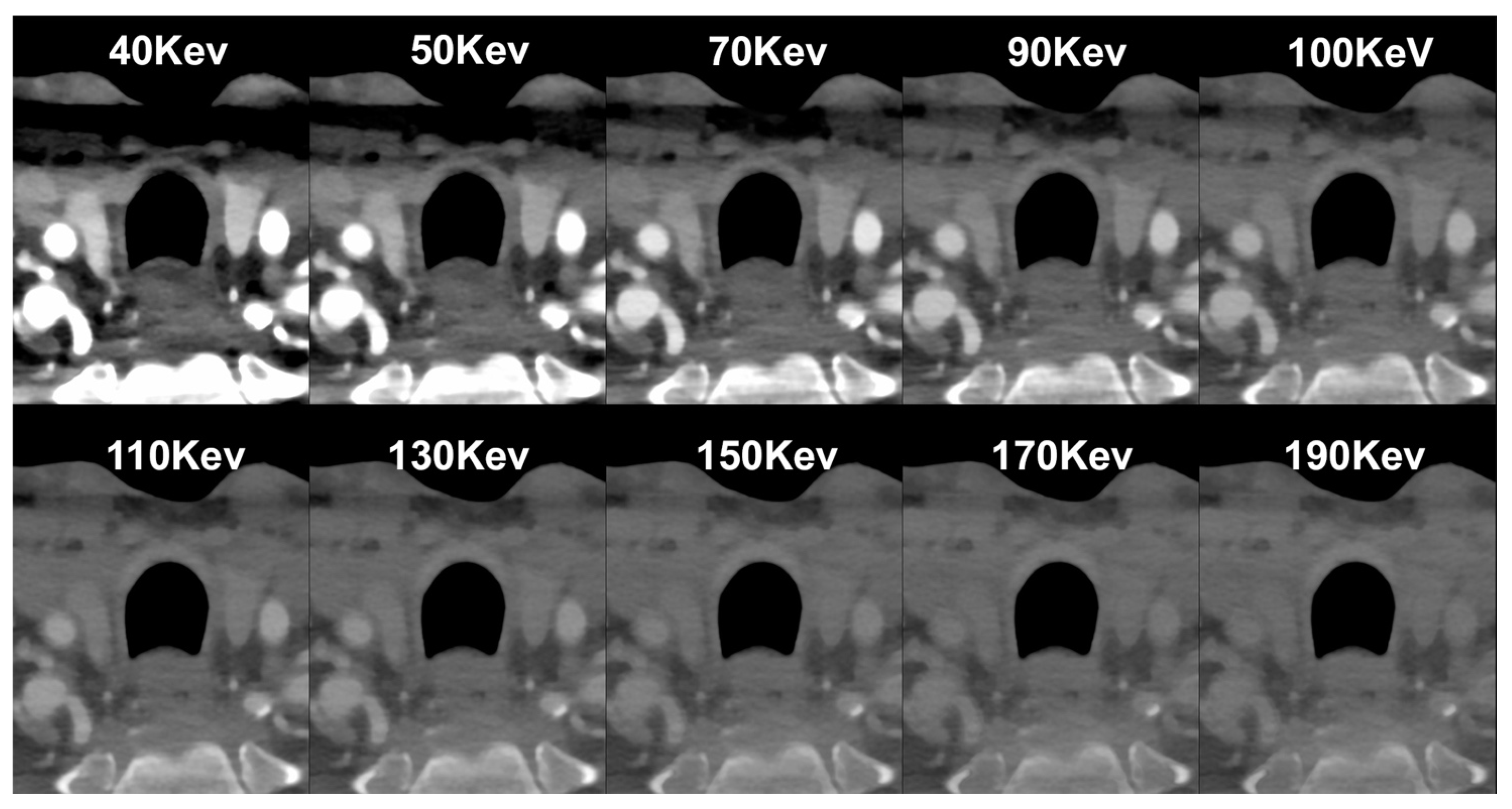 Diagnostics 14 01065 g001 Diagnostics 14 01065 g001